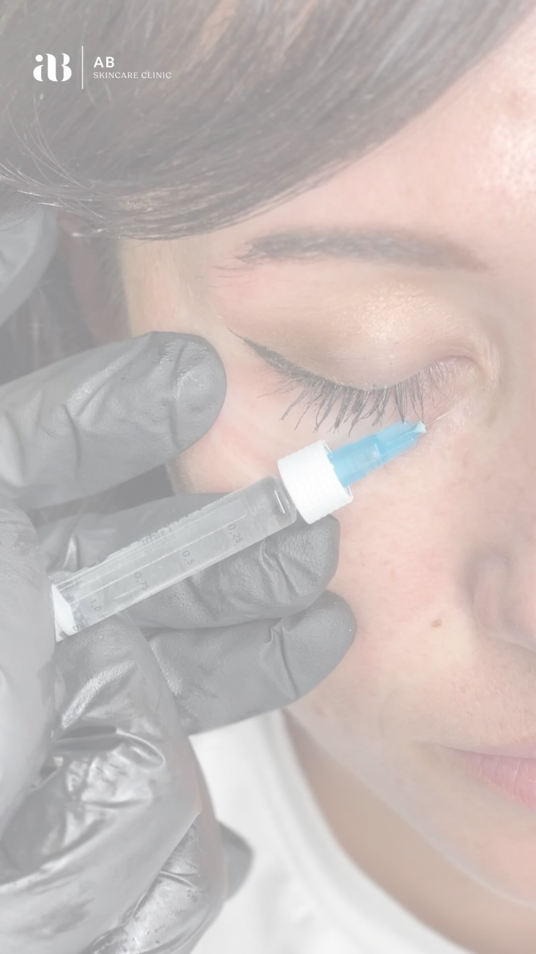 True under-eye regeneration ๐โจ
Polynucleotides are an advanced regenerative treatment that works at a cellular level to restore, strengthen and refine the delicate eye area. By stimulating collagen and improving skin quality from within, polynucleotides deliver a brighter, smoother, more youthful appearance โ without adding volume.
Expect:
โจ Refined texture
โจ Improved elasticity
โจ Brighter, healthier-looking eyes
โจ Long-term skin regeneration
For those who want timeless results, not temporary fixes.
AB Skincare Clinic
๐Talbot Green
๐งapril@abskincareclinic.co.uk
๐ฒ07763047220