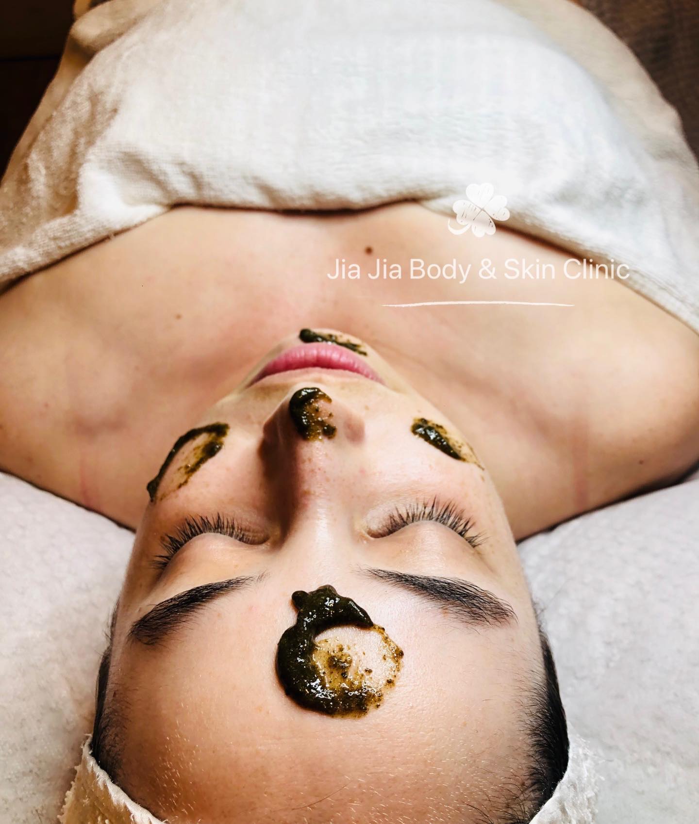 Jia Jiaās Clinic offers Three different Herbal Aktiv Peels. The Herbal Aktiv B Peel which targets all Skin types,
helps hydrating skin resurface the skin, no down time . The Phyto Peel, which is even stronger and again targets Acne, Pigment & Ageing. The Herbal Aktiv Correction Peel which is the strongest peel. New Skin in 5 Days. Recommended for acne, enlarged pores, scarring, ageing skin, loose skin, wrinkles and hyperpigmentation. This unique peel treatment includes aftercare products and a post-treatment after 5 days.
#jiajiabodyandskinclinic #herbalpeel #bpeel #drapilleraus #alexcosmetic #clearskin #organicskincare #acnetreatment #pigmentationtreatment #skintightening