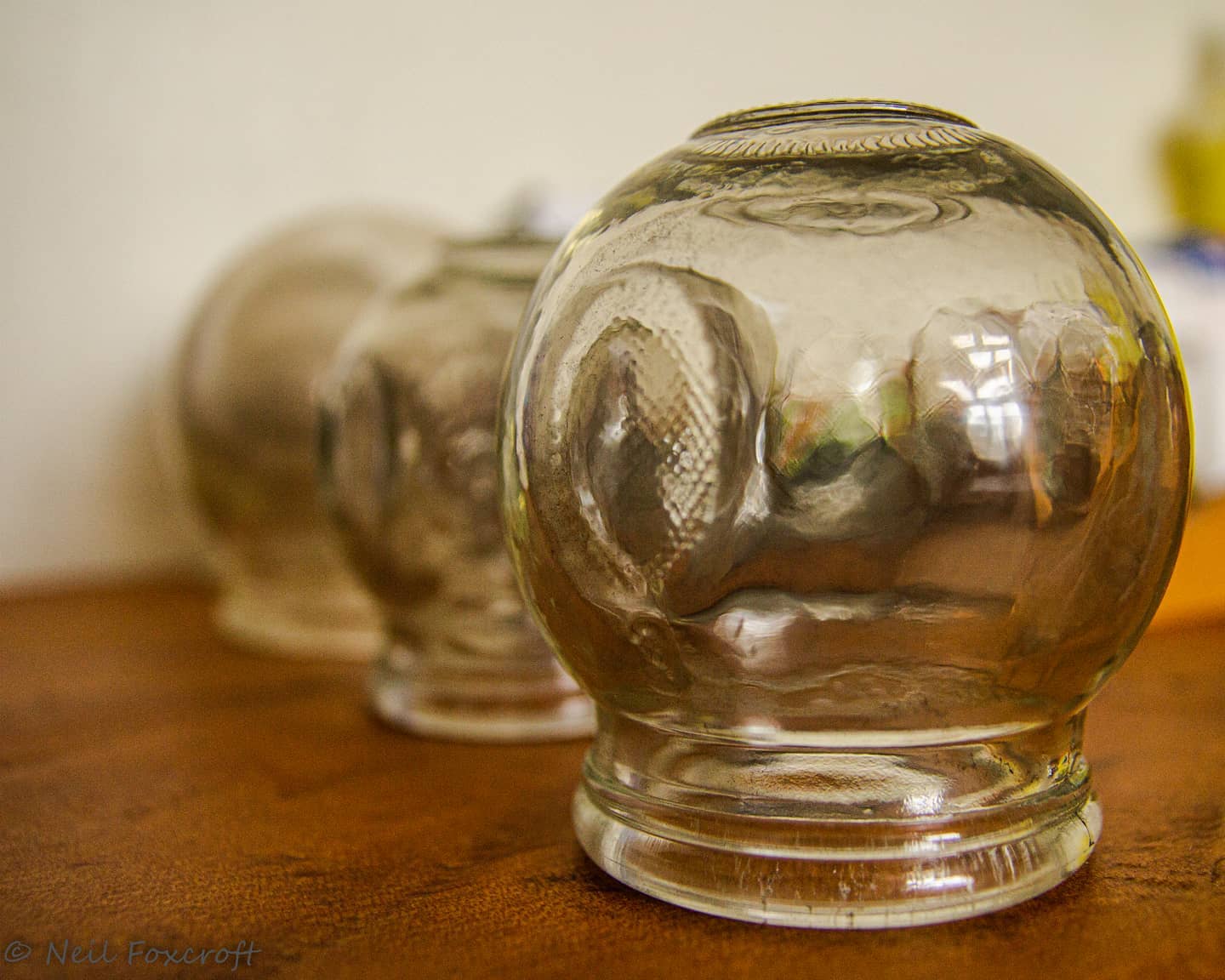 Glass and fire. Cupping in Chinese medicine is used for many things. Book your appointment now. Www.truepointhealingnz.com
#truepointhealing #acupuncture #naturalhealth