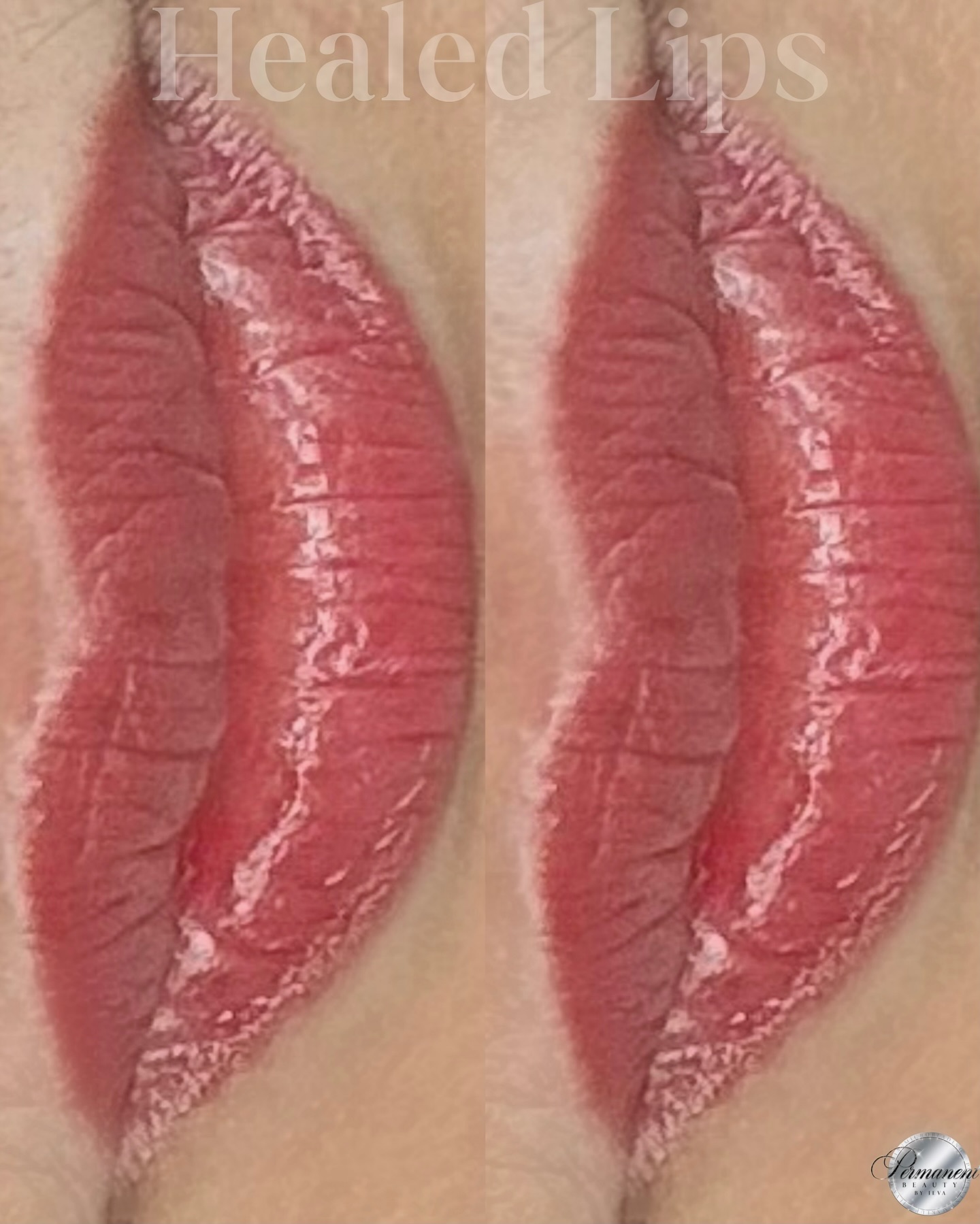 This is what true results look like after healing 🤍
Soft, even tone, no “lipstick effect.”
Lip neutralization is designed to gently correct uneven, dark, or cool-toned lips and bring them back to a natural, fresh shade that matches with your skin tone.
✨ Experience the best results for yourself. Follow the link in bio for booking.
#lipblushoshawa #oshawalips #oshawalipblush #whitbylips #oshawapermanentmakeup