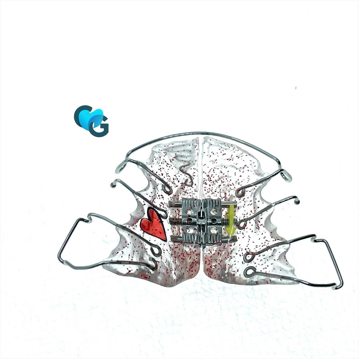 #orthodontie #ortho #orthocolors #orthopassion #coeur #expansionpalatine #leone