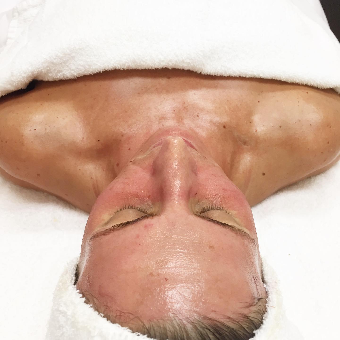 Check out that GLOW? This is just your blood circulation stimulated with organic AHA’s, quince, apples and a BioComplex booster of antioxidants, Coenzyme Q10, and Alpha Lipoic Acid, which helps to reduce the appearance of wrinkles and improve the quality of skin. The pinkness will subside within approx an hour — leaving your skin with an uber radiant and healthy glow! 🌿👌🏼