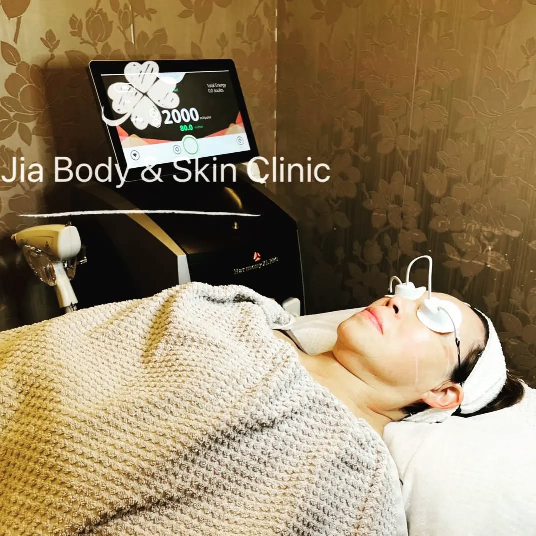 NOW (winter time) is probably the best time to get a laser treatment since you spend most of your time indoors out of the sun!!
Alma Laser can help with a variety of skin conditions: tightening, brightening, rejuvenation, you name it.
We love it especially for fine lines, sagging skin and pigmentation disorders. ♥️♥️
#almalaser #skincare #treatment #toprydecity #tightening #skinrejuvenation