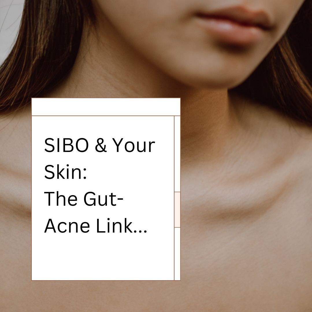 SIBO + acne… this is one of the most overlooked connections I see 👀
If you’re dealing with stubborn breakouts and things like:
👉 Bloating after meals, gas, reflux, constipation/loose stools, food sensitivities, flushing/itchy skin…
it might not be “just hormones” or “just skincare”.
SIBO (small intestinal bacterial overgrowth) can drive acne through a few key pathways:
👉 More inflammation + endotoxins
nutrient depletion (skin can’t heal properly)
histamine load (reactive, red, inflamed skin)
slower elimination → oestrogen recirculation + hormone imbalance (often seen alongside PMS + endo patterns)
And the reason it can feel like acne keeps coming back?
Because if we don’t support motility, gut lining repair, and relapse prevention, the cycle repeats.
🔍Want support working out whether SIBO or gut imbalance is contributing to your acne?
DM me “CLEAR SKIN” and I’ll send you the info on testing + my treatment approach (tailored herbs, acupuncture & manual gut motility treatment)
#acnehelp #adultacne #hormonalacne #guthealth #sibosupport