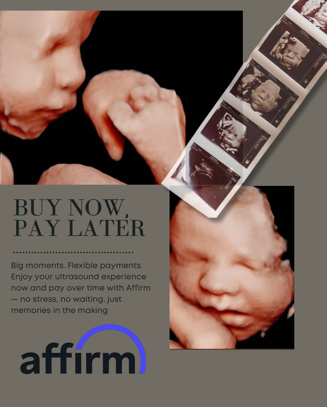 Swipe for a simple step by step on using Affirm at checkout ✨ Approval is quick, but your appointment is only secured once checkout is completed and your date & time are scheduled using the confirmation link in your email 🤍
Affirm is available on purchases over $95 and approval is determined by Affirm. Questions? Call or email me anytime ✨