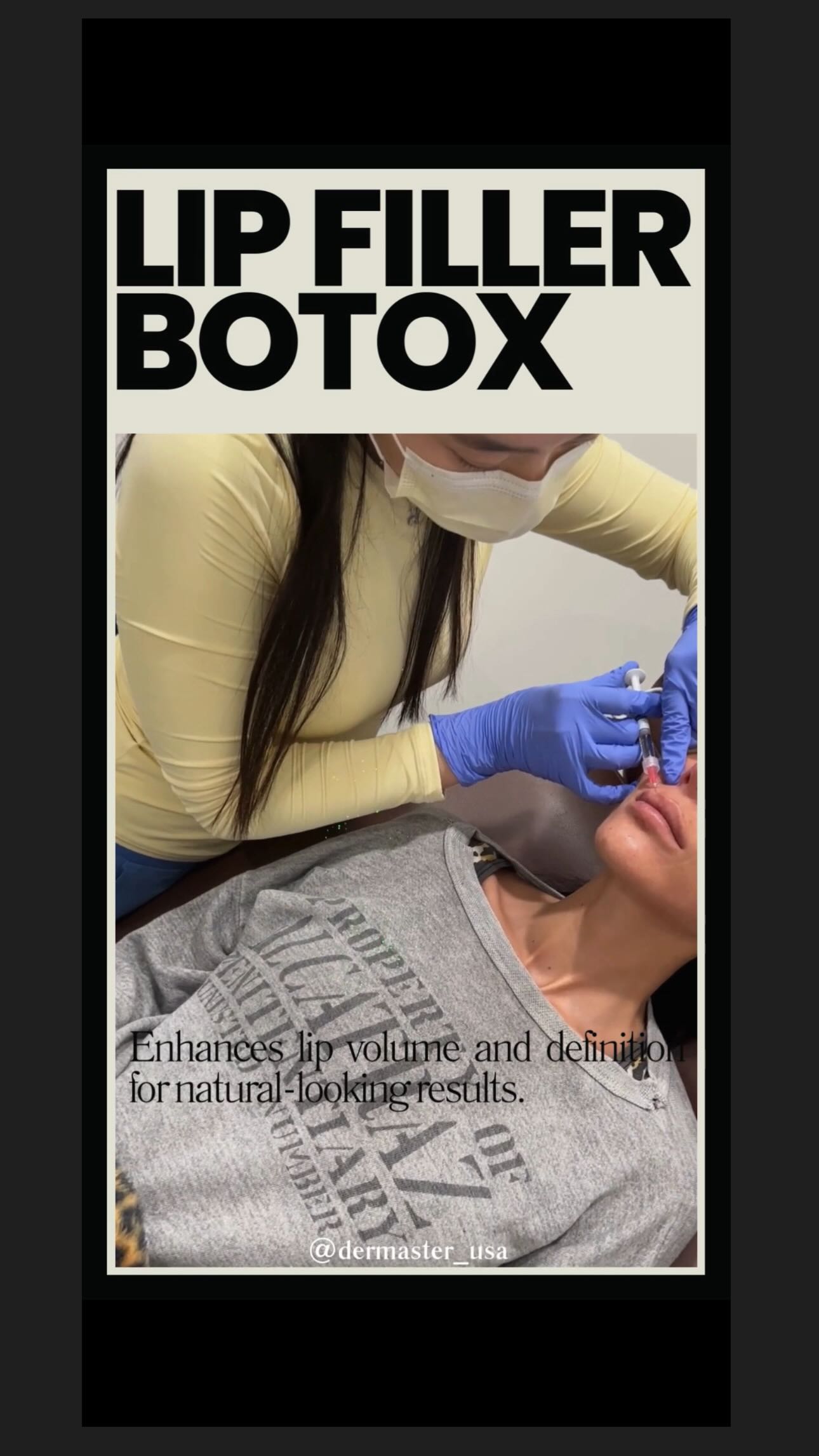 입술은 더 또렷하게 💋
턱 라인은 더 자연스럽게 ✨
필요 없는 필러는 깔끔하게 리셋 🔄
✔ 립 필러 + 보톡스
✔ 턱 필러 + 리쥬란
✔ 필러 디졸브
과하지 않게, 얼굴 비율에 맞춰
상담 후 필요한 시술만 진행합니다 🤍
Define the lips 💋
Enhance the chin ✨
Dissolve what’s not needed 🔄
✔ Lip Filler + Botox
✔ Chin Filler + Rejuran
✔ Filler Dissolve
Customized treatments based on your facial balance,
only what you need after consultation 🤍
📍 3000 W. Olympic Blvd. #305, Los Angeles, CA 90006
📞 (213) 814-8410
#LipFiller#ChinFiller#Rejuran#FillerDissolve#FillerRemoval#NaturalFiller#FacialBalance#FacialContour#AestheticClinic#DermClinic#LADerm#KBeautyLA#CustomizedTreatment#BeforeAfter