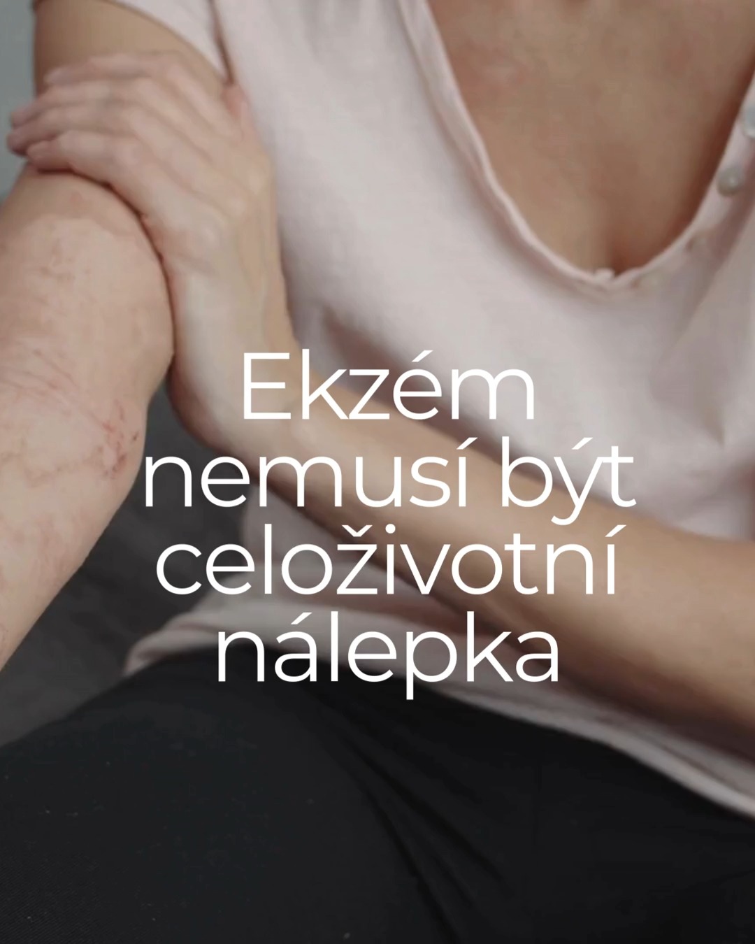 Ekzém často není problém kůže.
Je to signál.☝
Signál, že se v těle něco dlouhodobě děje –
ve střevech, imunitě, zánětu, stresu.
Naturopatie nehledá viníka.
Hledá souvislosti.
Ne každý ekzém má stejnou příčinu.
A právě proto nefunguje jedno univerzální řešení.
Pokud máš pocit, že tahle cesta by mohla být pro tebe, můžeš mi napsat❤️