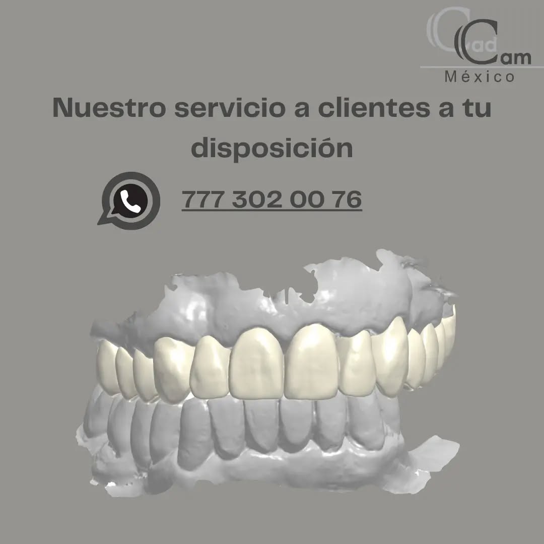 Ponte en contacto con nosotros y con mucho gusto diseñaremos y fabricaremos tu trabajo. Manda tu trabajo y archivos STL. a info@cadcam-mexico.com - - - Aviso de responsabilidad: Todas las fotos publicadas en esta cuenta de Instagram son propiedad intelectual de Estudio de Porcelana Suizo S.A de C.V. y están protegidas por derechos de autor. #CadCam #Mexico #Cromocobalto #implantologia #implantesdentales #dentistry #dentista