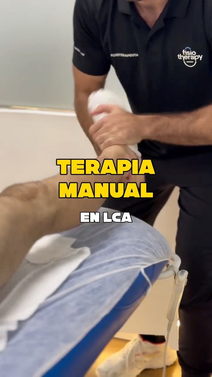TERAPIA MANUAL EN EL LCA 🦵🏼🤩
La rehabilitación del ligamento cruzado anterior es un proceso complejo en el que la fisioterapia acompaña al paciente con múltiples herramientas y técnicas.
Una de ellas es la terapia manual. Y es que tendemos a reducir su uso a las fases iniciales, para la ganancia de ROM y reducción de la inflamación. Pero cumple un papel muy importante durante todo el proceso, también en fases intermedias y avanzadas.
🎯 Hoy os dejamos algunos ejemplos de este trabajo en fase avanzada, en el que buscamos:
▪️Mejorar los movimientos accesorios de deslizamiento, rotación y pivote
▪️Facilitar la biomecánica articular para la sesión de readaptación en sala
▪️ Ganancia del ROM máximo pasivo de todas las articulaciones: cadera, rodilla y tobillo-pie.
#aclrehab #lca #fisioterapiadeportiva #terapiamanual #knee