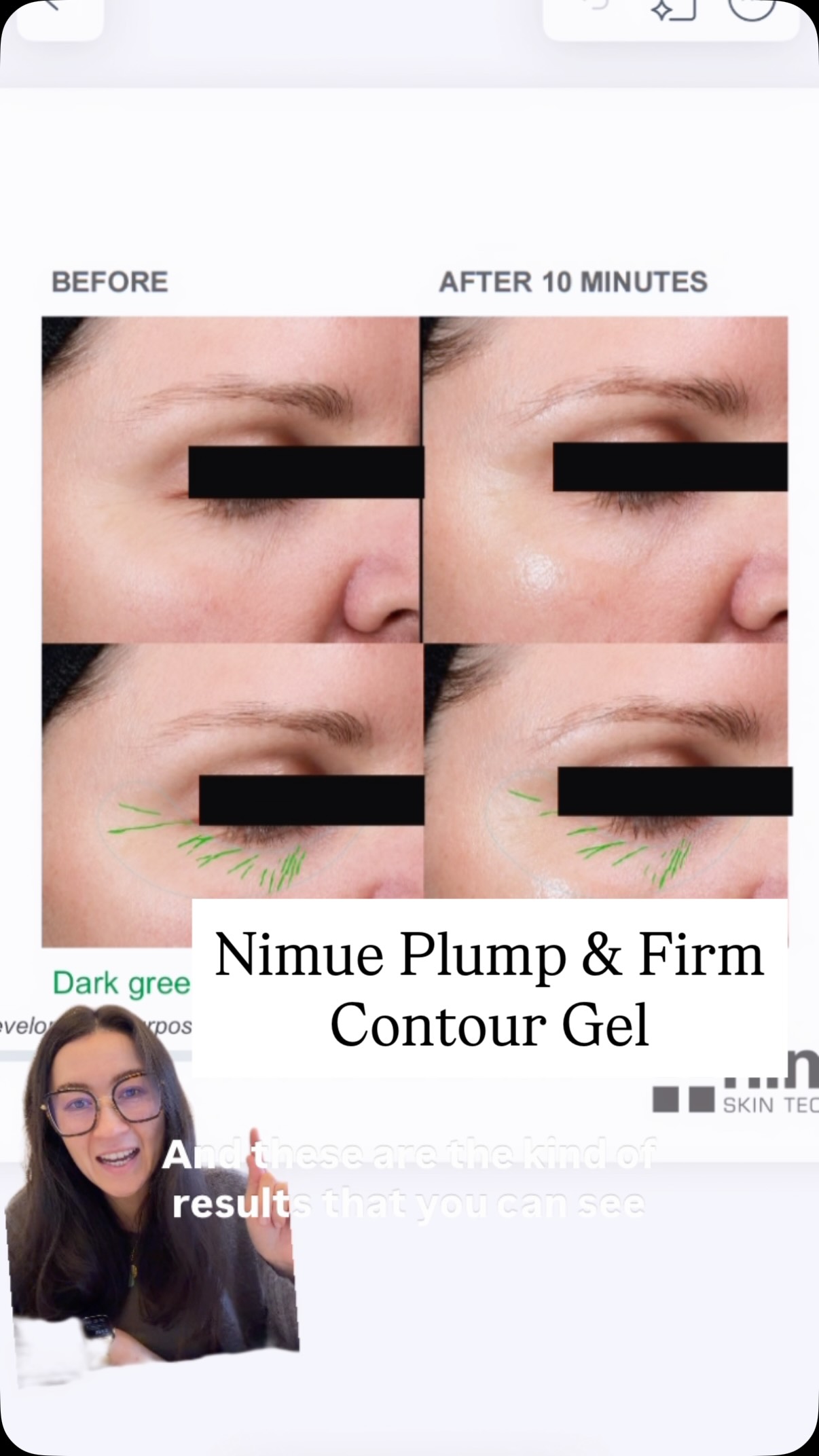 In love with this new product to the point I’ve stopped wearing under eye concealer! 😮 DM me to order
#skincare #eyecream #eyes