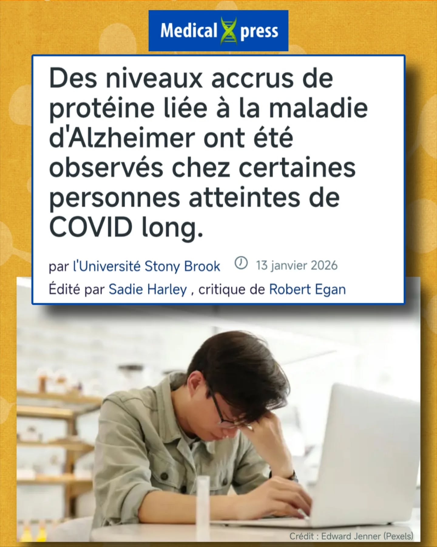 🧵🧪Une nouvelle étude publiée dans eBioMedicine montre une augmentation significative de la protéine tau phosphorylée (pTau-181) chez certaines personnes atteintes de #CovidLong avec symptômes neurocognitifs.
🧠Les chercheurs de l’Université Stony Brook ont analysé des biomarqueurs sanguins chez 227 personnes présentant des séquelles neurologiques post-aiguës de la COVID-19 (N-PASC).
Les symptômes comprenaient :
- Troubles cognitifs
- Maux de tête
- Vertiges
- Troubles de l’équilibre
- Altérations du goût et de l’odorat
🔬 La protéine mesurée, pTau-181, est une forme anormale de la protéine tau.
Un excès de pTau-181 est classiquement associé à :
- Lésions neuronales durables
- Maladies neurodégénératives, comme #Alzheimer
📊Point fort de l’étude : les chercheurs disposaient de prélèvements sanguins🩸AVANT l’infection, puis plusieurs mois à plusieurs années APRÈS, permettant une comparaison intra-individuelle très robuste.
📈Résultat central : augmentation moyenne de 59 % de la pTau-181 plasmatique après infection par la #COVID19 chez les personnes atteintes de N-PASC, pendant ou après l’apparition des symptômes neurocognitifs persistants.
👥 Les 227 patients N-PASC ont été comparés à 227 témoins qui :
- n’avaient pas eu la COVID
- ou n’avaient développé aucun #CovidLong
Aucune augmentation de pTau-181 n’a été observée dans le groupe contrôle.
🗣Sean Clouston, PhD :
«La présence de la protéine tau à des niveaux élevés dans le sang est un biomarqueur connu de lésions cérébrales durables. Ces résultats suggèrent que le #CovidLong pourrait s’aggraver avec le temps et entraîner des modifications des symptômes neurologiques ou des troubles cognitifs qui s’accentuent.»
⚠️Prudence :
«Nous ignorons si cette augmentation de la protéine tau représente une évolution biologique comparable à celle observée dans la maladie d’ Alzheimer.»
L’étude ne conclut donc pas à un lien direct, mais met en évidence un signal biologique préoccupant.
⏳Chez les personnes symptomatiques depuis plus de 18 mois, l’augmentation de pTau-181 est encore plus marquée, ce qui pourrait présager une détérioration des fonctions cognitives avec l’âge.
⏬Suite en commentaire⏬ @frm_officiel