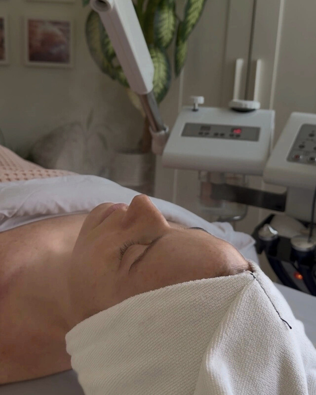 Here’s what warm steam does for winter skin:
• Softens buildup + surface dryness
Cold weather can cause dead skin and oil to cling more stubbornly to the surface. Steam gently softens this layer, making exfoliation and extractions more effective — without being aggressive.
• Prepares the skin for hydration
Steam increases skin permeability, helping serums, masks, and nourishing products absorb more effectively. This is key in winter, when skin often struggles to hold onto moisture.
• Supports circulation + glow
Warmth encourages healthy blood flow, bringing oxygen and nutrients to the skin’s surface — supporting that post-facial brightness without overstimulation.
• Helps ease congestion
By loosening trapped oil and debris, steam allows congestion to release more comfortably, rather than forcing it out.
• Calms the nervous system
Beyond the skin, steam creates a parasympathetic response — helping the body relax, which directly impacts how the skin responds to treatment.
We use steam intentionally — not to “open pores,” but to prepare, soften, and support the skin before moving into deeper work.
Yes, it feels incredible.
But in winter especially, it’s doing quiet, essential work behind the scenes.
✨ Comment WINTER for details on our SOS Steam + Stone Facial . ✨