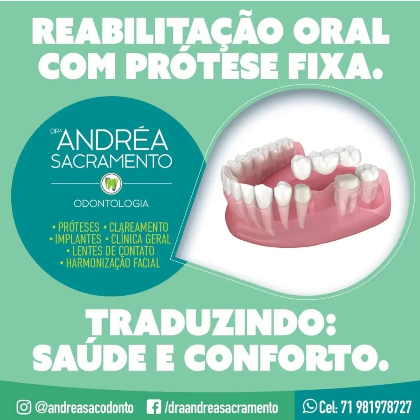 Mais uma opção para sua reabilitação protética.
Prótese fixa em cerâmica.
#proteseprotocolo #dentistasalvador #estetica #saudebucal #harmonizaçaofacial #clareamento #gengivoplastia #acidohialuronico #botoxsalvador #leparcsalvador #alphavillesalvador #brisassalvador #greenvillesalvador