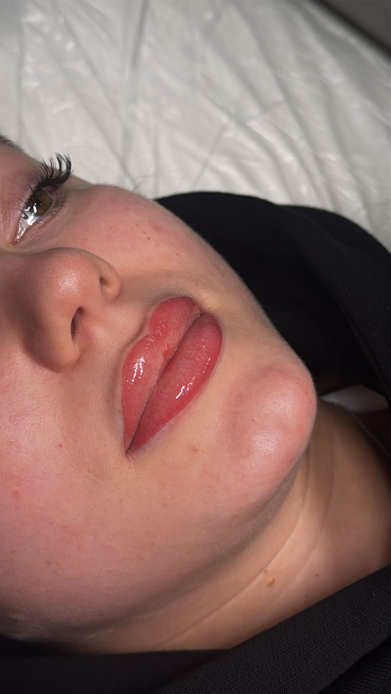 Here’s a step by step of what happens at your lip blush appointment 👄
Step 1️⃣ Consultation
We start with a full consultation to talk through your expectations, desired results, colour goals, and a thorough lip inspection to ensure you’re suitable for treatment.
Step 2️⃣ Colour selection
Together, we select the perfect shade for your lips — tailored to your natural tone, undertones, and the result you want to achieve.
Step 3️⃣ Mapping
Your lips are carefully mapped to enhance shape and symmetry. We don’t move forward until you’re 100% happy and have approved the design.
Step 4️⃣ Lip blush time
Once everything is agreed, the lip blush treatment begins — creating soft, natural colour and beautifully defined lips.
✨ Every step is calm, professional, and client-approved — no surprises.
Why clients love lip blush 👄✨
• Enhances natural lip colour
• Defines shape & symmetry
• Creates the illusion of fuller lips
• Corrects uneven tone
• Long-lasting, low maintenance results
Wake up with beautiful lips every day.
Must be 18+.
On offer for £100 💸
#lipblushmanchester #lipblushbolton #lipblushing #lipblushwigan #lipblushtattoo