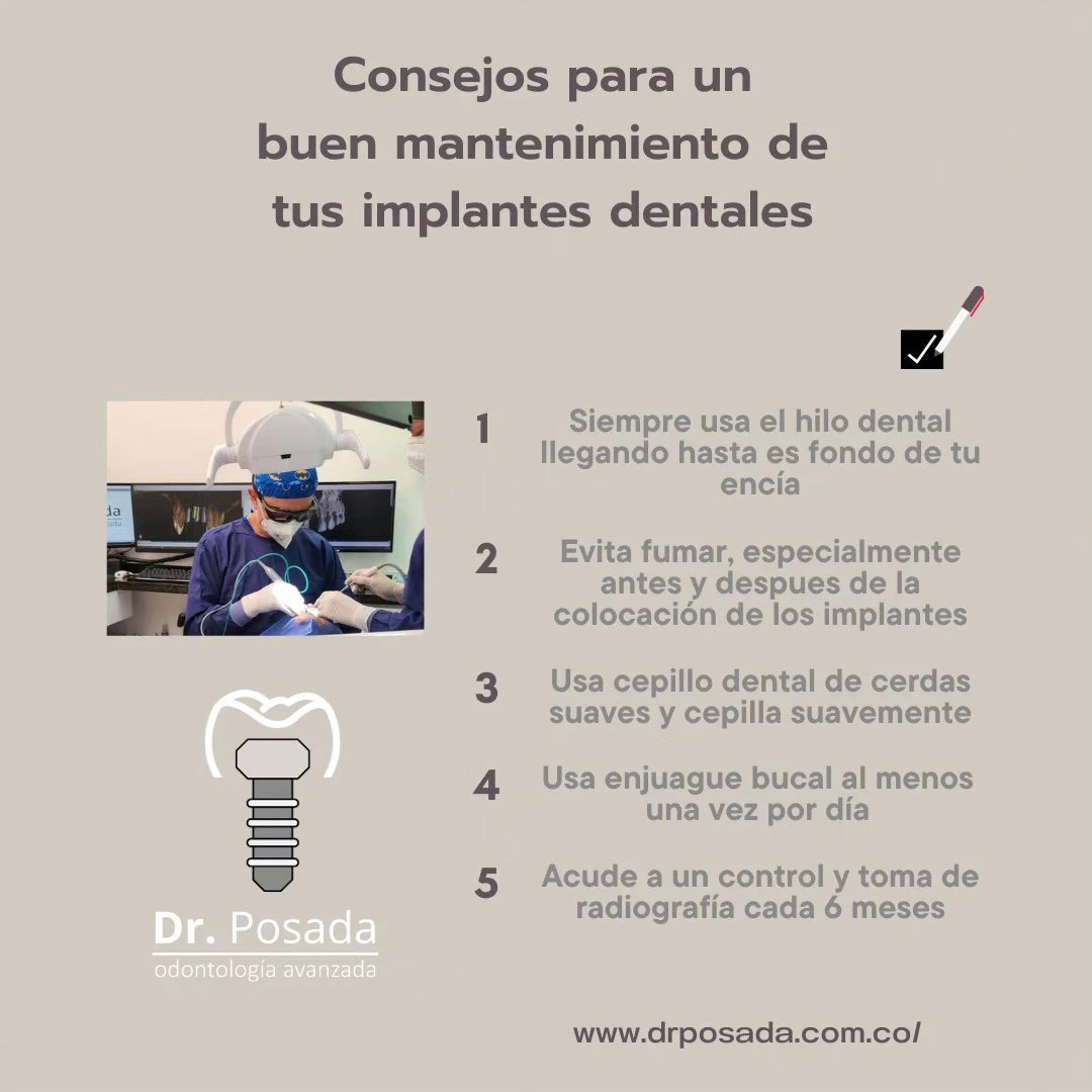 #consejos para un buen mantenimiento de tus #implantes dentales @dr.posada.
.
.
.
.
.
.
.
.
.
.
#consejo #cuidados #implantesdentales #control #sedadental #dientessanos