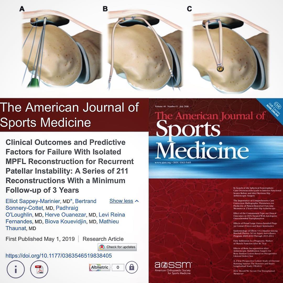 Great team effort! Another publication in AJSM. About recurrent patellar instability. #kneesurgery #santigroup #emiratessportsmed #aossm #ajsm
