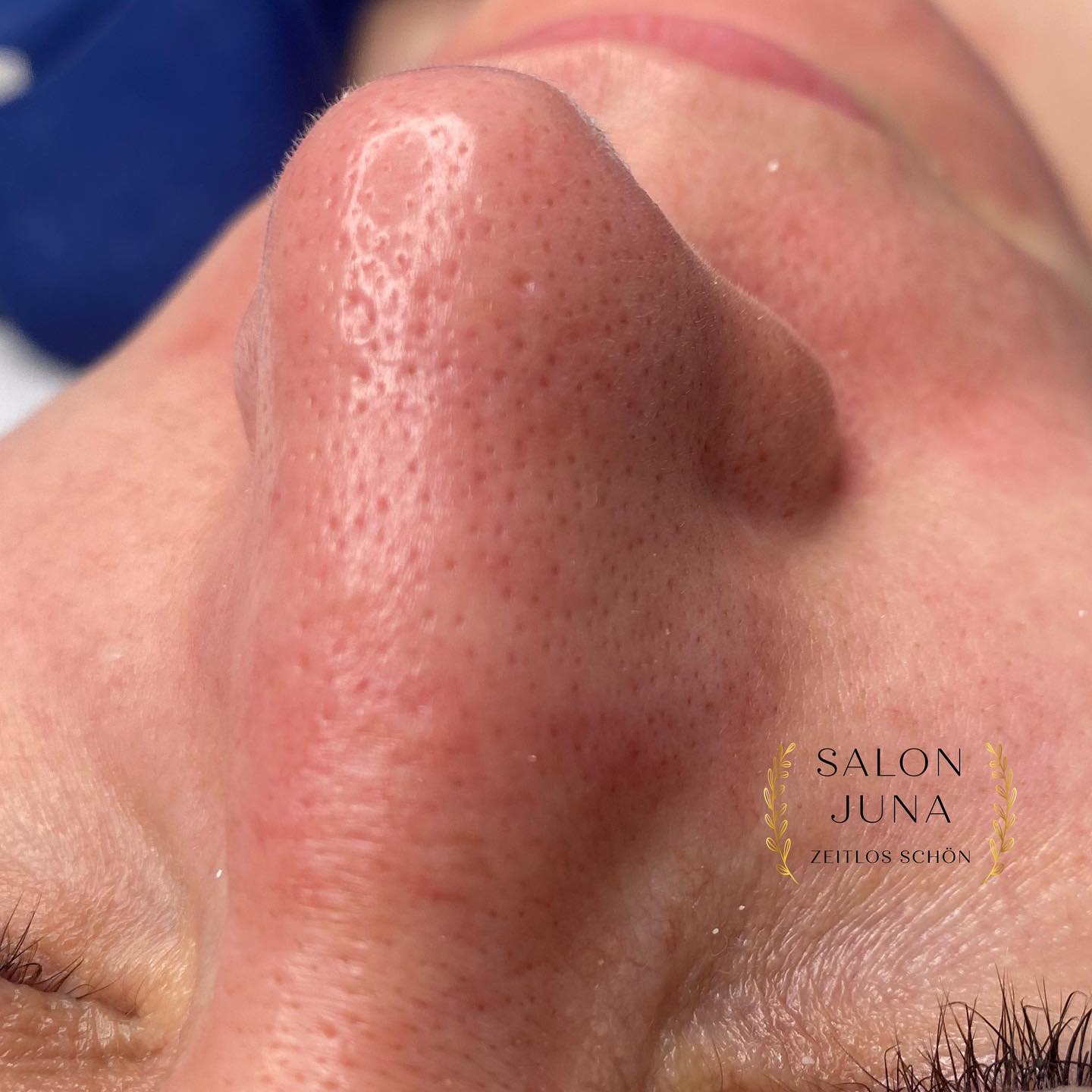 ✨ Tiefenreine Haut – das Geheimnis strahlender Frische ✨
Unsere Haut ist täglich Umwelt, Make-up und Stress ausgesetzt – da kann es leicht zu verstopften Poren und Unreinheiten kommen.
Bei einer professionellen Ausreinigung werden Talg, Schmutz und abgestorbene Hautzellen sanft entfernt – für ein frisches, reines und ebenmäßiges Hautbild. 🤍
Nach der Behandlung kann deine Haut wieder frei atmen, Pflegeprodukte werden besser aufgenommen und der Teint wirkt sofort klarer & vitaler. 🌿
💆♀️ Gönn deiner Haut regelmäßig diese Auszeit – sie wird es dir danken.
📍 Salon JUNA – Zeitlos schön
#ausreinigung #gesichtsbehandlung #hautpflege #salonjuna #zeitlosschön #beautyimallgäu #klarenhaut #skincarelover #gesundehaut #facialtreatment