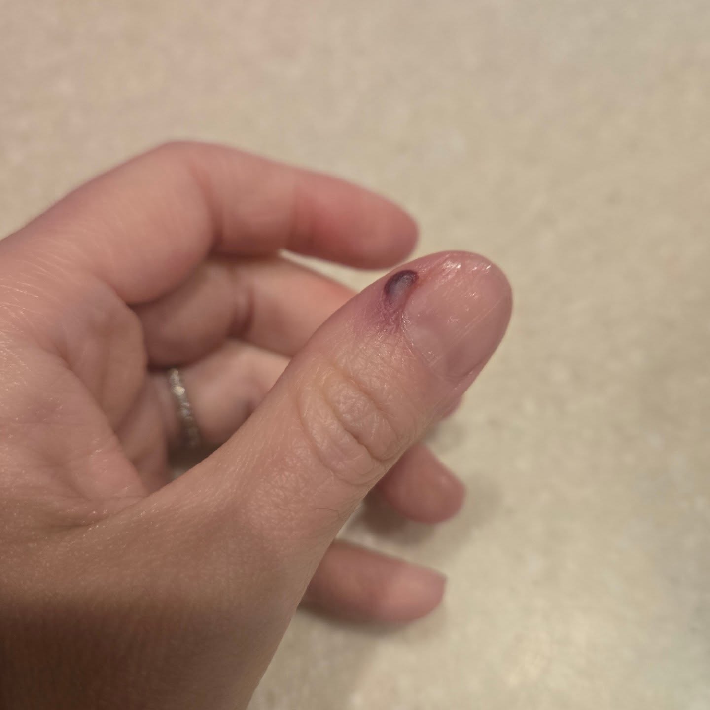 Preparing for record cold ❄️
Tried reinforcing a window from the inside with a comforter.
Instead, I reinforced my thumb with a hammer. 🔨😅
Simple living, but make it clumsy.
The cold is coming.
I’ll survive.
My thumb… TBD.
Tell me about your diy injury in the comments... 😅
#simplegroundedlife
#ouch