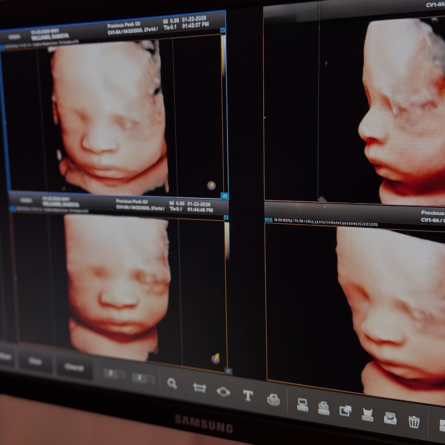 when technology & technique meet 🤝😍