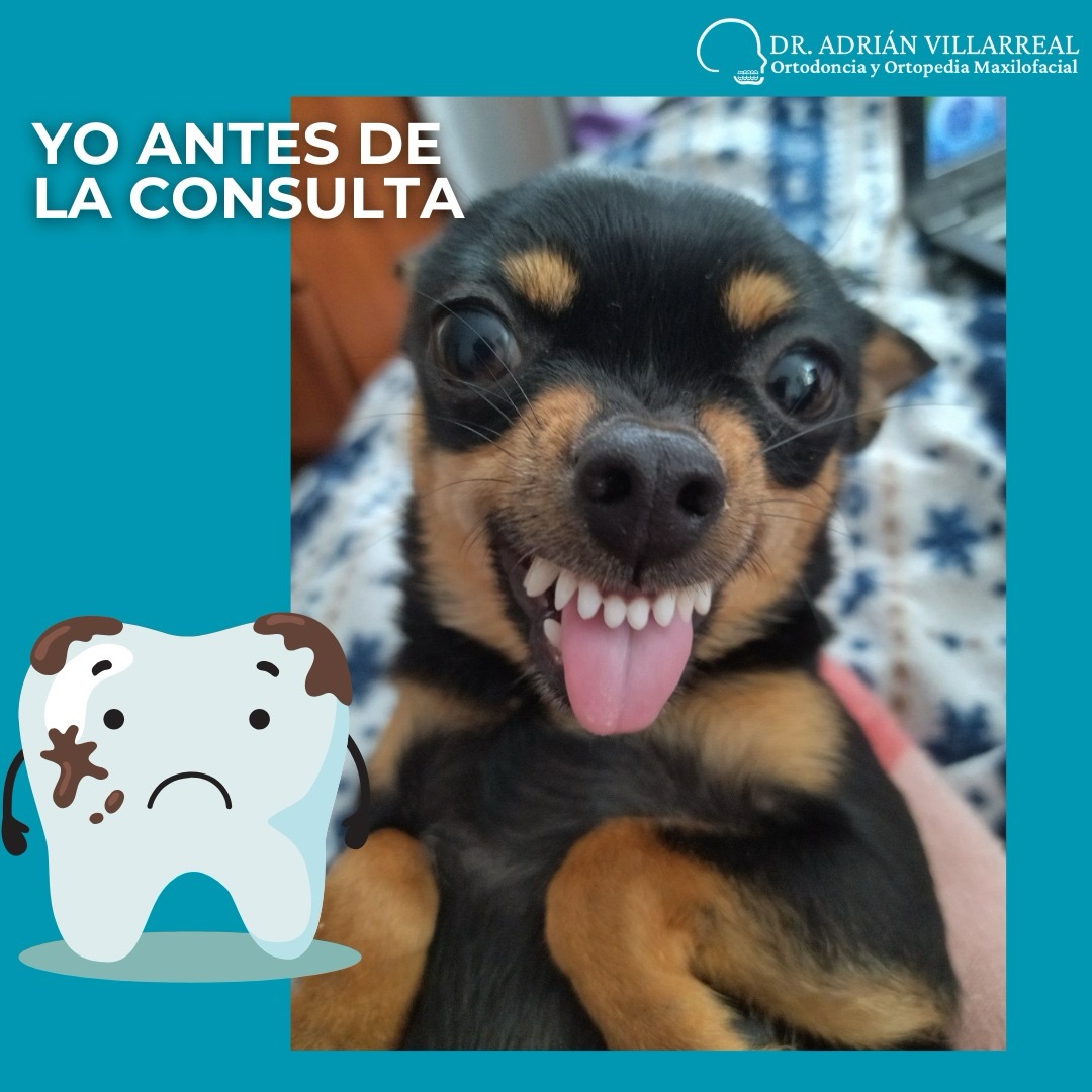 🦷 Sonrisita nueva😁👌
.
.
.
.
.
.
UANL Ced. Prof. 12948881
UANL Ced Maestria: 14532598
COFEPRIS: 2419032002A00440
.
.
.
#dentista
#odontologo
#brackets
#dentistasanpedro
#Ortodoncista
dentistamonterrey