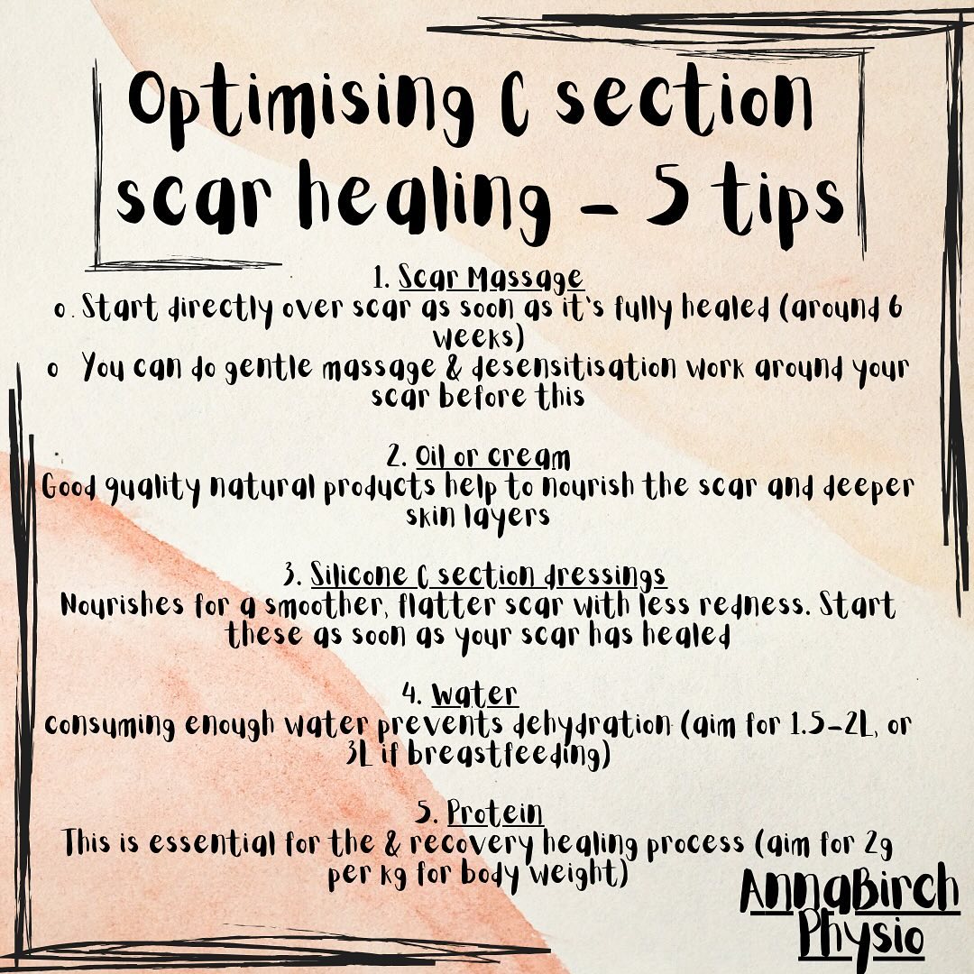 5 ways to optimise your C section scar healing!
These techniques work really well together to reduce pain, sensitivity & inflammation, promote flexibility in the scar & surrounding tissues which will reduce tightness!
Assessment of your C section scar is a routine part of my postnatal Mummy MOT. Or if you know you’re going to have a C section, all of these & more are covered in detail in my C section advice sessions.
Visit my website for more info & to book online!