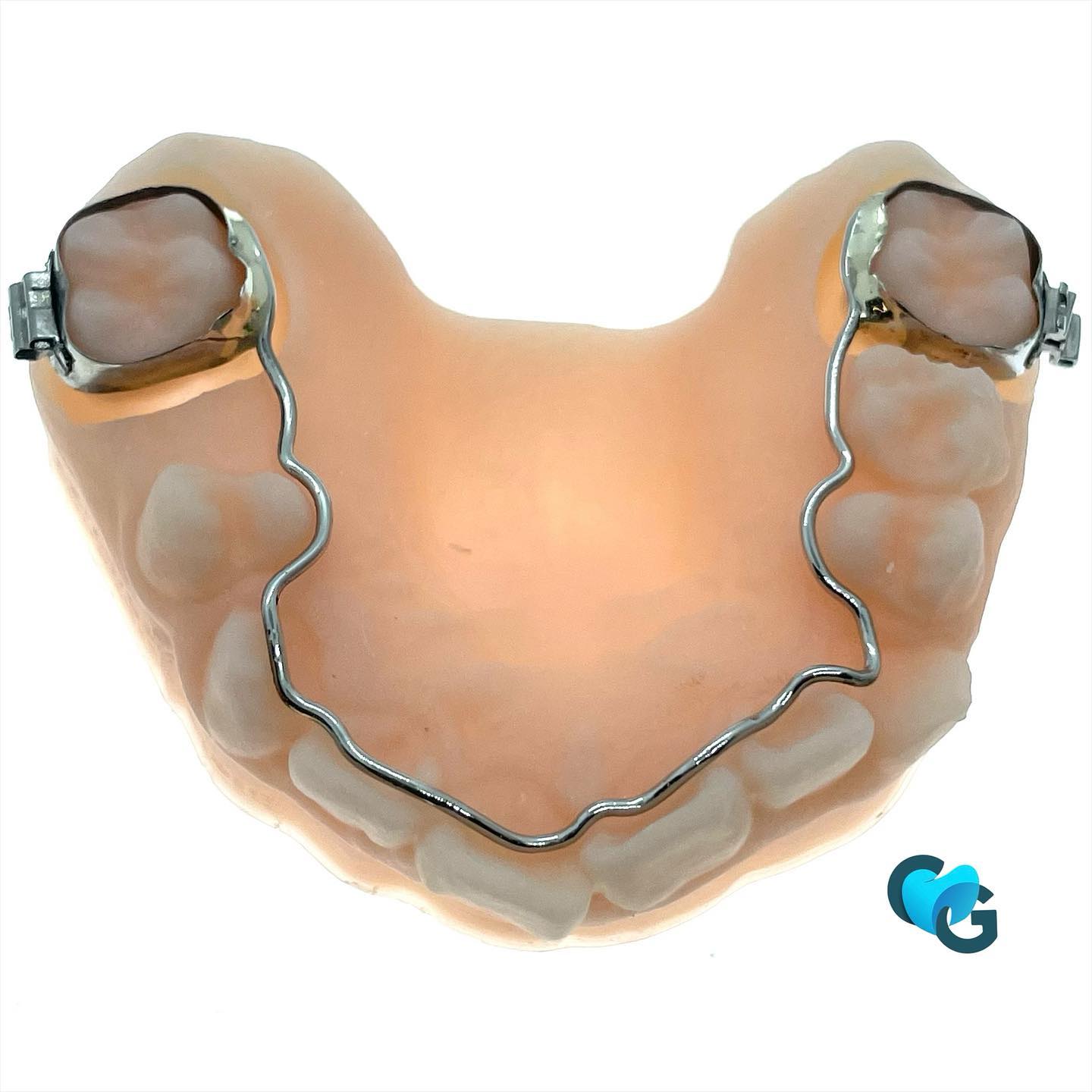 Contention soudée sur 16-26
#contention #ortho #findetraitement #orthofix #orthopassion #dentaire #dental #teeth
