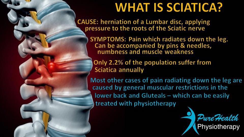 Know the difference between Sciatica and pain referred into the leg from muscle tightness.
Contact us today:
www.purehealthphysio.co.uk
Info@purehealthphysio.co.uk
07443419973
• Feltham
• Sunbury-on-Thames
#physiotherapy #sportsrehab #sportsmassage #acupuncture #dryneedling #lowbackpain #lowbackpainrelief #sciatica #sciaticarelief #feltham #sunburyonthames