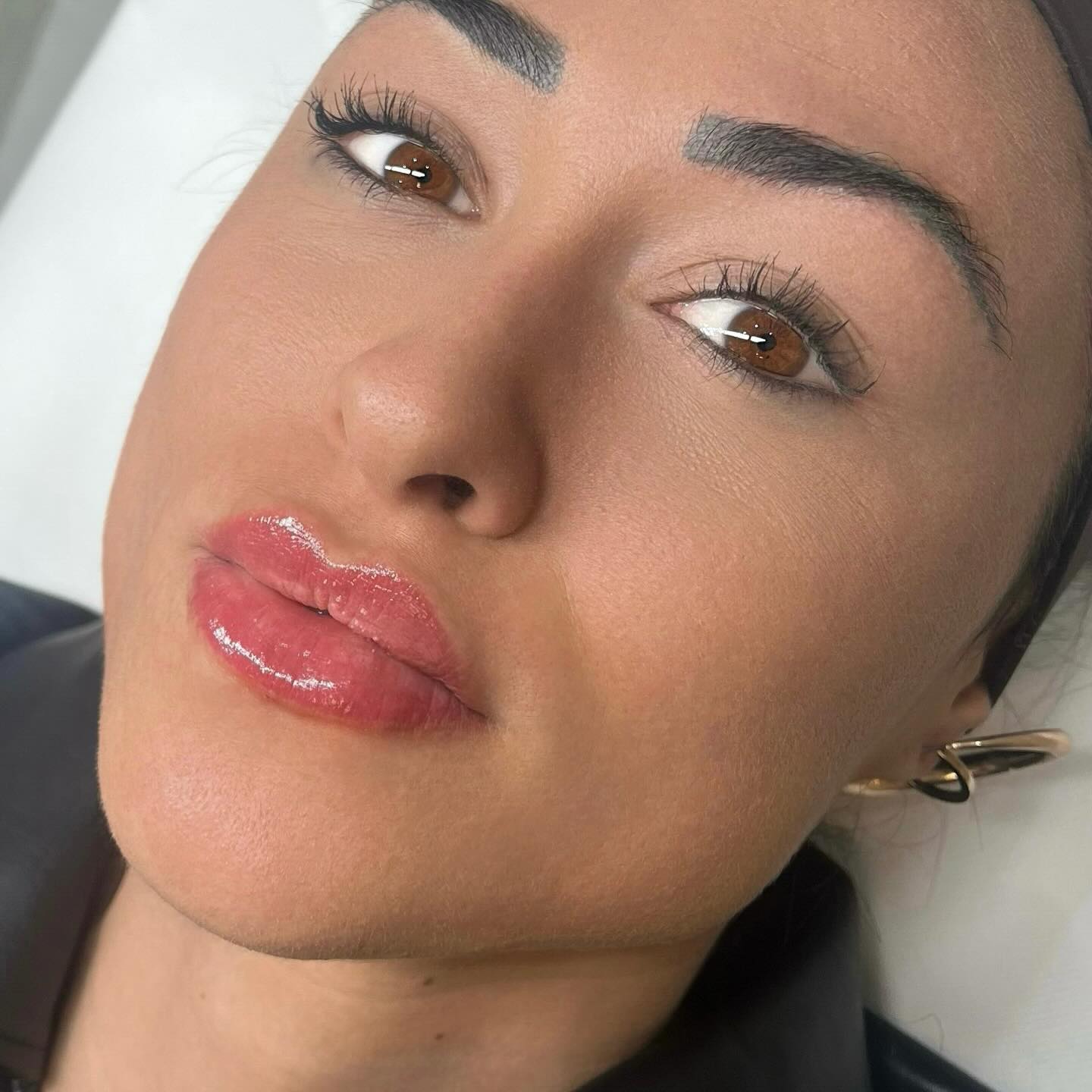 Natural Lippen 👄 💉✨
#hyaluronsäurelippen #lippenvergrößerung #lippenästhetik #bamberg #beauty