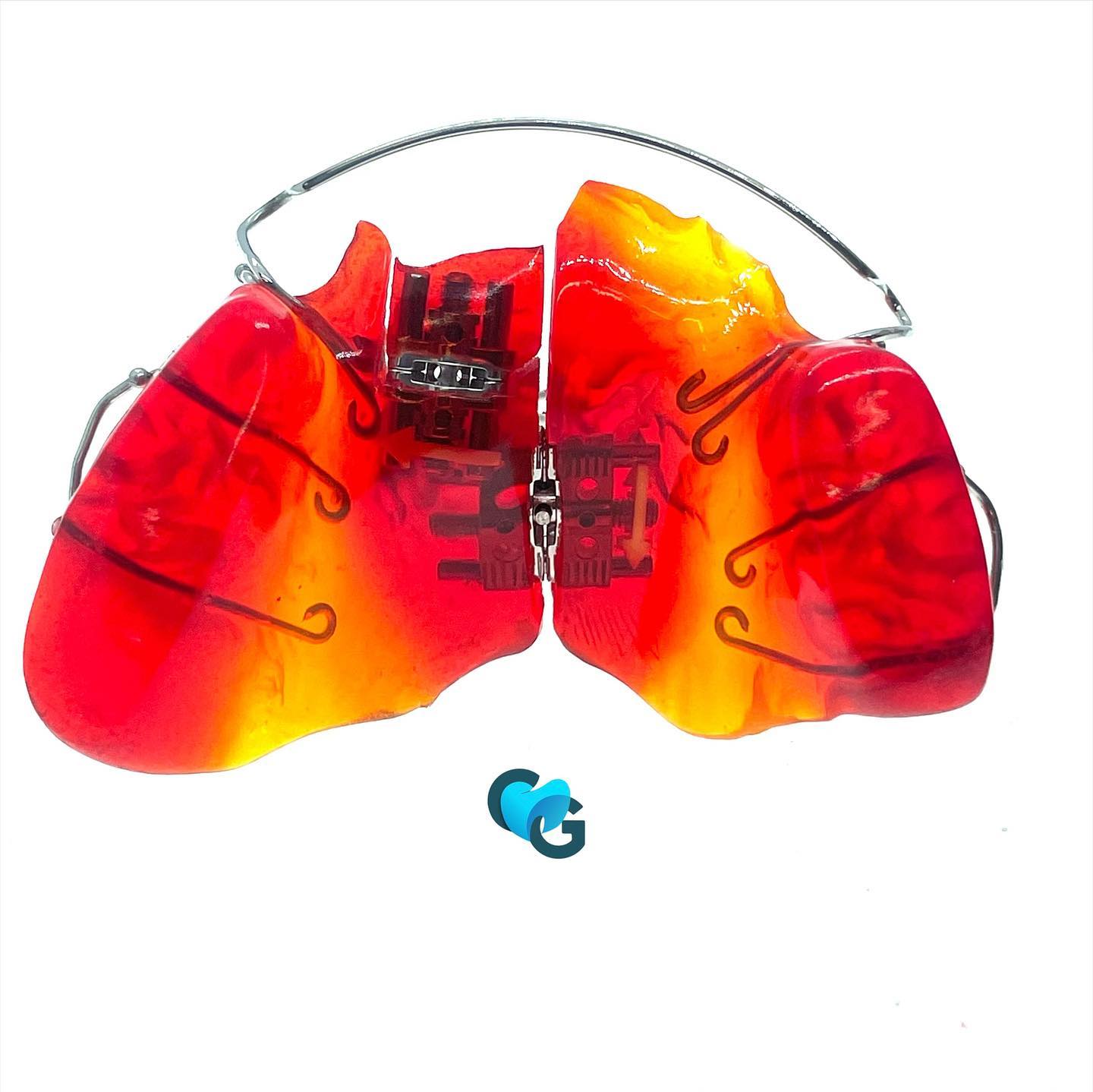 #volcano #orthodontictechnician #ortho #plaqueortho #plaqueexpansion #orthotooth #orthocolors #orthopassion #orthodontie #orthodontic #orthotics