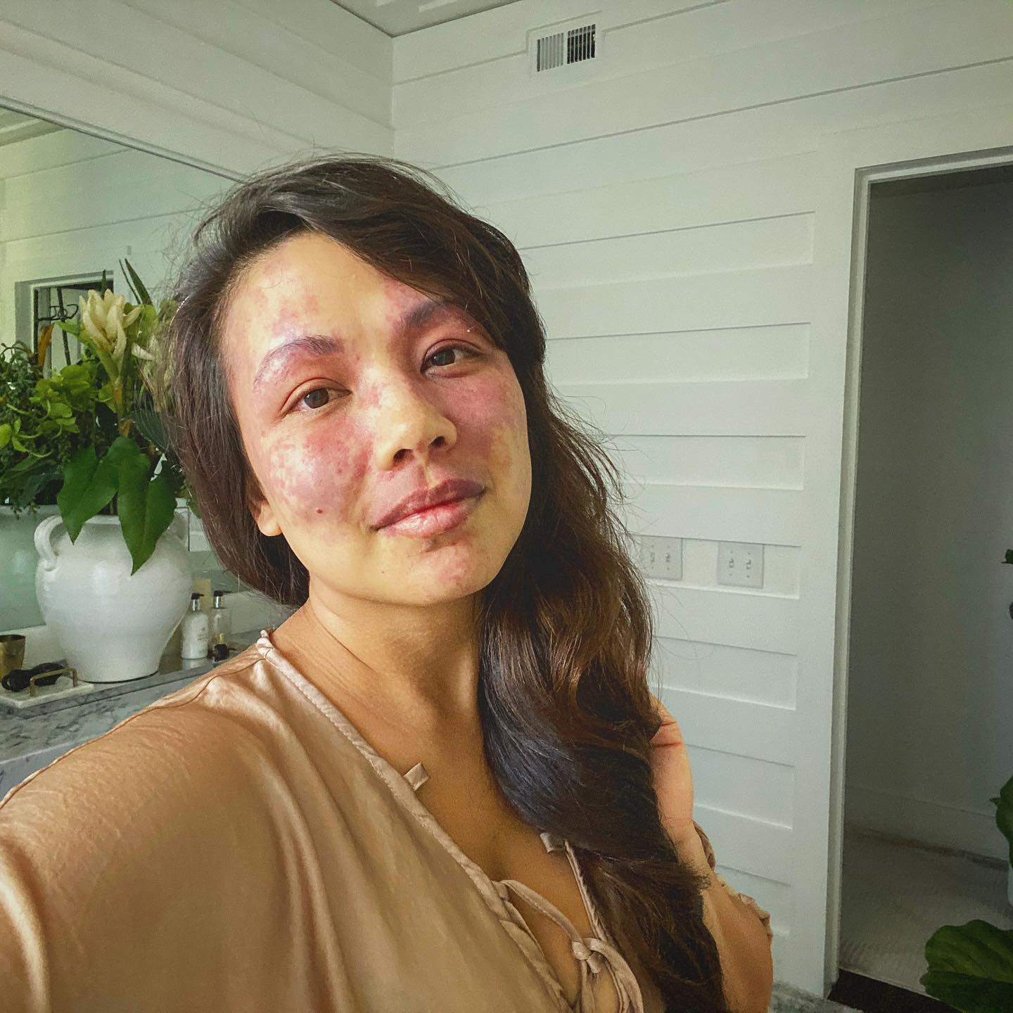 No makeup Monday’s has turned into an everyday.
On the one hand it’s great. But makeup is a two sided sword for me. I love it and I hate it. I love makeup in the way every girl does... it’s fun and a form of self expression. I hate it because applying it, as fun is one thing but for work feels like a chore. When I have makeup on I feel freedom but it is a freedom that leaves me with mixed emotions, sadness and resentment.
I wonder if all of you love make up the way I do. Something you truly enjoy but leaves you with a little dark corner in your mind that reminds you that with out it on, the world meets your birthmark first and you second.
Makeup does not shield me, and my birthmark does not define me.
I love both ❤️with them or with out them I am still me. #portwinestains #sturgewebersyndrome #sturgeweberawareness #birthmark #birthmarksarebeautiful #birthmarkbeauty #birthmarkremoval #portwineproud #portwinestain