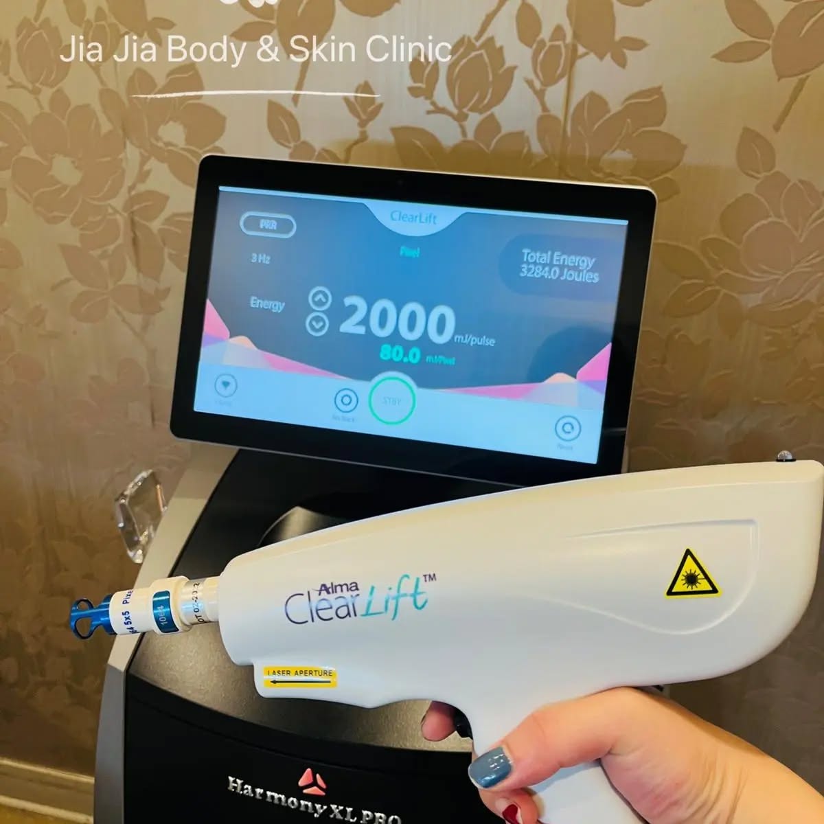 Alma's ClearLift Laser is one of the best technologies in Jia Jia Body and Skin Clinic to combat against photoaging skin!
This is a Q-switch laser with 1064nm wavelength which can target 5 depths of the layers to treat the skin condition. It is an non-ablative measure with a photoacoustic effect that stimulates the cells with literally little to no down time and effects are almost immediate!
During the treatment you might see some bright lights and hear a zap or two. We will put goggles on you for protection and maybe you'll look a bit pink for about 30mins to an hour afterwards but that's it! ✨✨✨NO DOWN TIME✨✨✨
For example, we can aim it at the deep dermis layer to stimulate fibroblasts for collagen production and help tighten the skin. OR! We can use it for treating epidermal or dermal melasma
It is multi functional and super versatile. It's indications also include:
- skin laxity
- fine lines and wrinkles
- benign pigmented lesions (melasma, sunspots) 🌞
This treatment is suitable for all ages, as a skin treatment or preventative measure.
Don't be shy, walk in whenever for a consultation so we can get the most amazing results for you! ☺️☺️
#almalaser #qswitchlaser #rejuvenation #skinscience #skincare #beauty #facial #treatment
