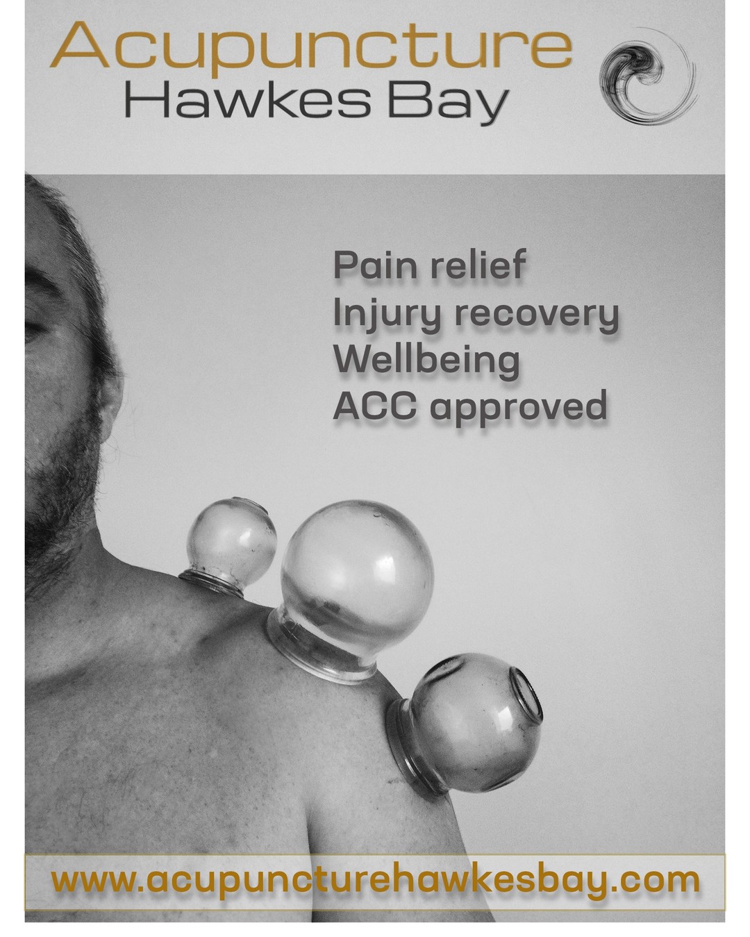 Pain?
Have you tried acupuncture or cupping?
Book a session, you might be surprised.
ACC approved provider