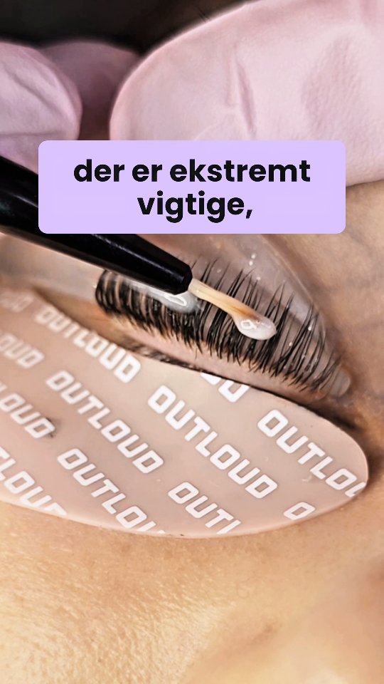 Kender du de her to linjer?
Hvis ikke, er det ofte derfor, dit lash lift ikke bliver, som du ønsker.
Placeringen af væskerne er afgørende.
Den øverste linje bestemmer, hvor meget vippen bukker i længden.
Den nederste linje bestemmer, hvor meget løft du får direkte fra roden.
Små justeringer kan gøre en stor forskel i resultatet.
Husk: Væskerne virker kun dér, hvor de bliver placeret.
Gem videoen, hvis du vil have mere kontrol over dit lash lift 🩷🩷
⠀
#lashlift #lashlifttips #lashliftteknik #lashartist #lashliftprofessionel