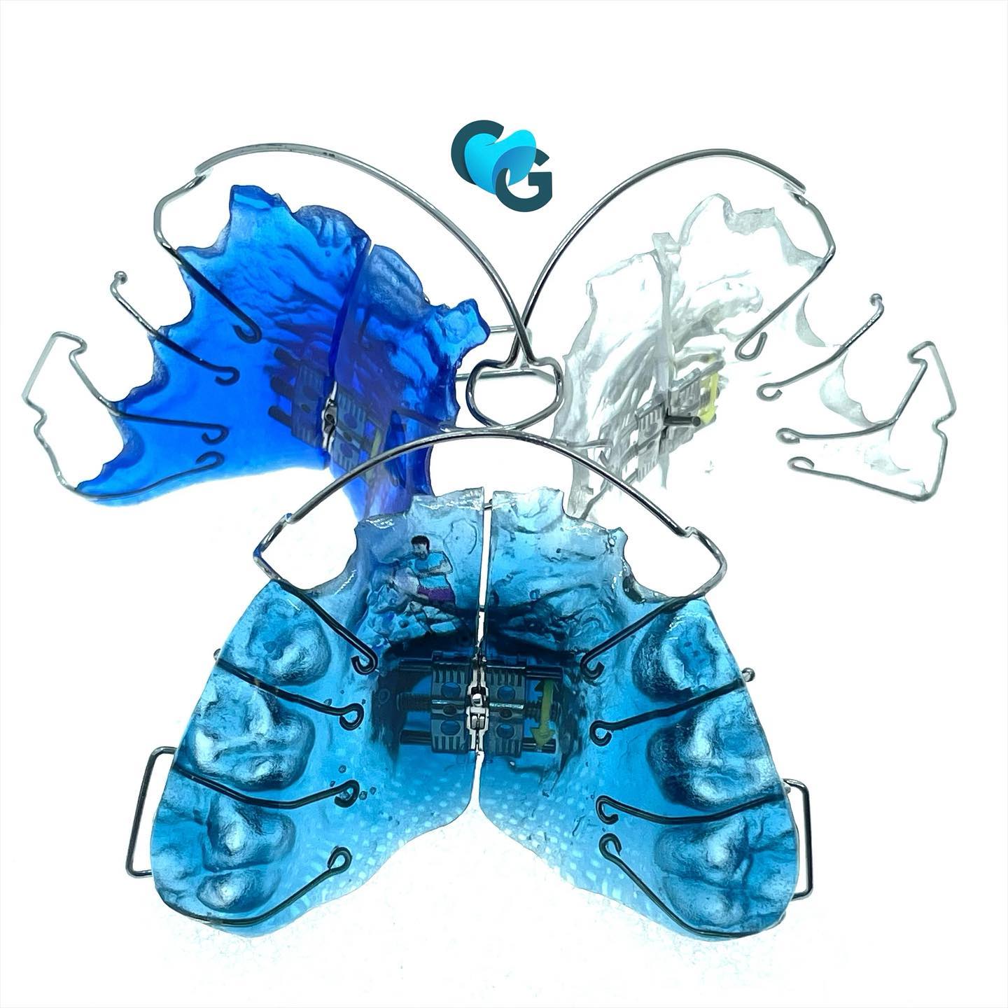 #orthodontie #orthopassion #ortho #expansionpalatine #orthocolors #orthodontieenfant #dentaire #techniciendentiste