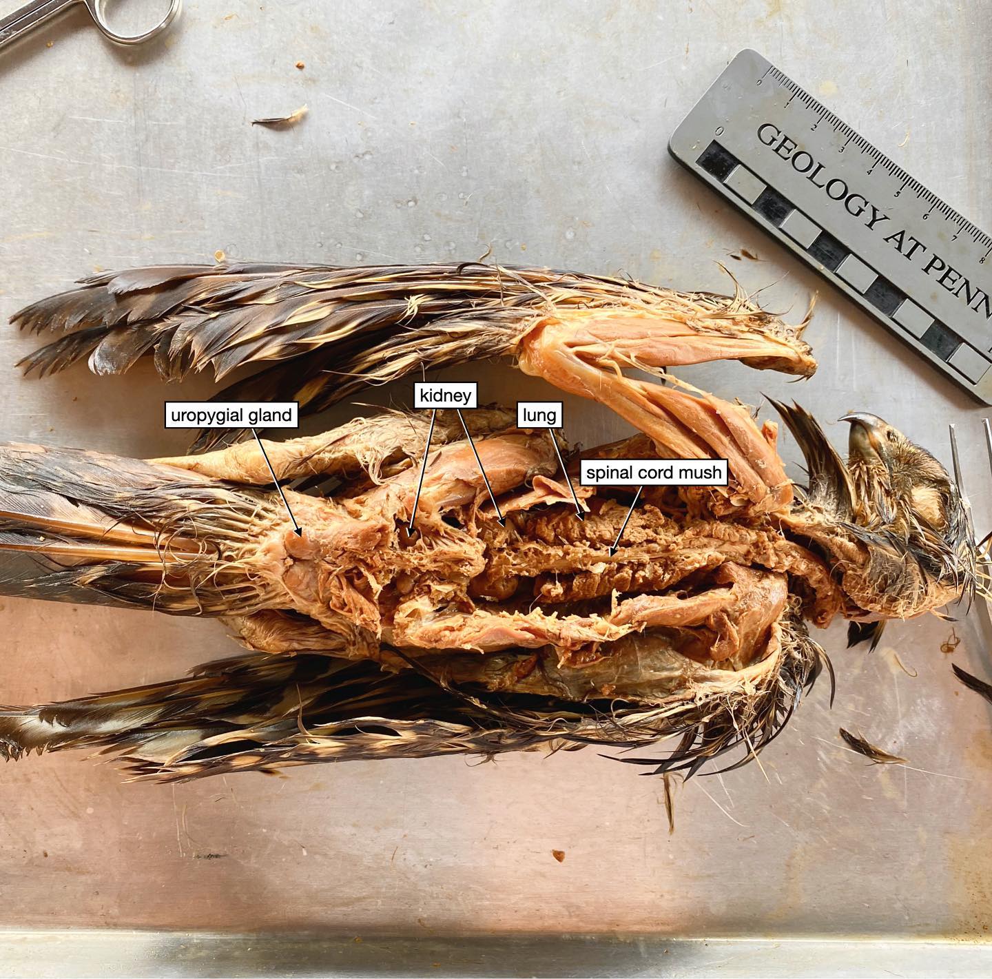 Hawk Dissection Part 1. Doing science so often doesnāt work out the way we want or expect. I put this small hawk in acetone to fix the soft tissues a few months ago. My plan was to cut open the skull to seen the brain, and cut open the vertebrae to see the spinal cord (basically, do a laminectomy). The central nervous system decays VERY rapidly, and was too far gone when I put it in, so even with the acetone my plan didnāt work. ā¹ļø The brain was really crumbly and fell into pieces, and the spinal cord was just mush. But all was not lost!
.
To do the laminectomy and cut open the skull, I had been dissecting from the dorsal side of the animal (the back). I basically removed all of the muscles from the back as well as the ribs and most of the bone of the vertebrae. And I was left with a pretty cool dissection!
.
From this approach, you can see organs that are held deep in the body cavity against the back body wall, like the lungs and kidneys (birds have three-lobed kidneys, and we can see the anterior and posterior lobes here). The uropygial glands are also nicely preserved. These are glands on bird rumps that secrete oils they use to preen their feathers.
.
Pretty cool, right? But oh, this little guy has SO many more anatomical treasures...Stay tuned for even more cool stuff!
.
#hawk #anatomy #dissection #ornithology #birdsofinstagram #livingdinosaur #science