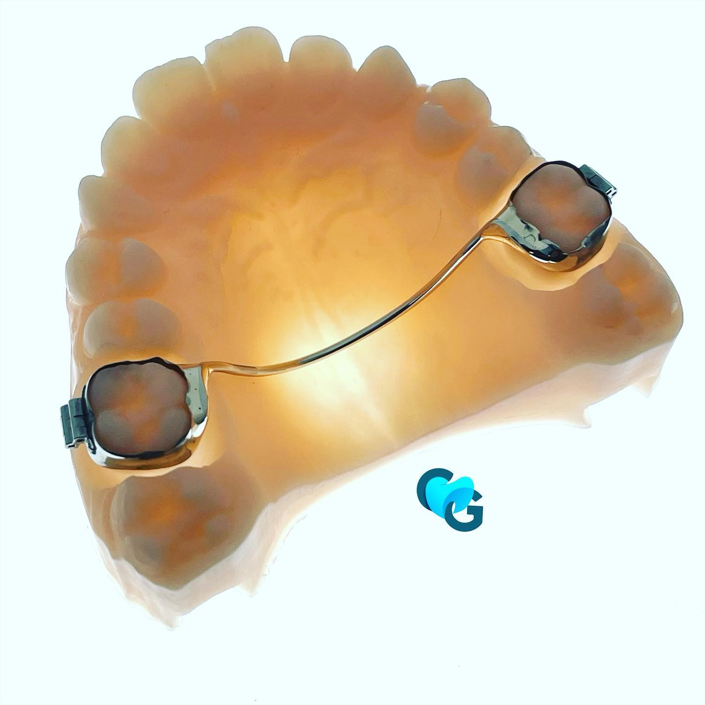 #arctranspalatin #ortho #orthodontic #ortotoothlab #orthodontictechnician #labodental #contention