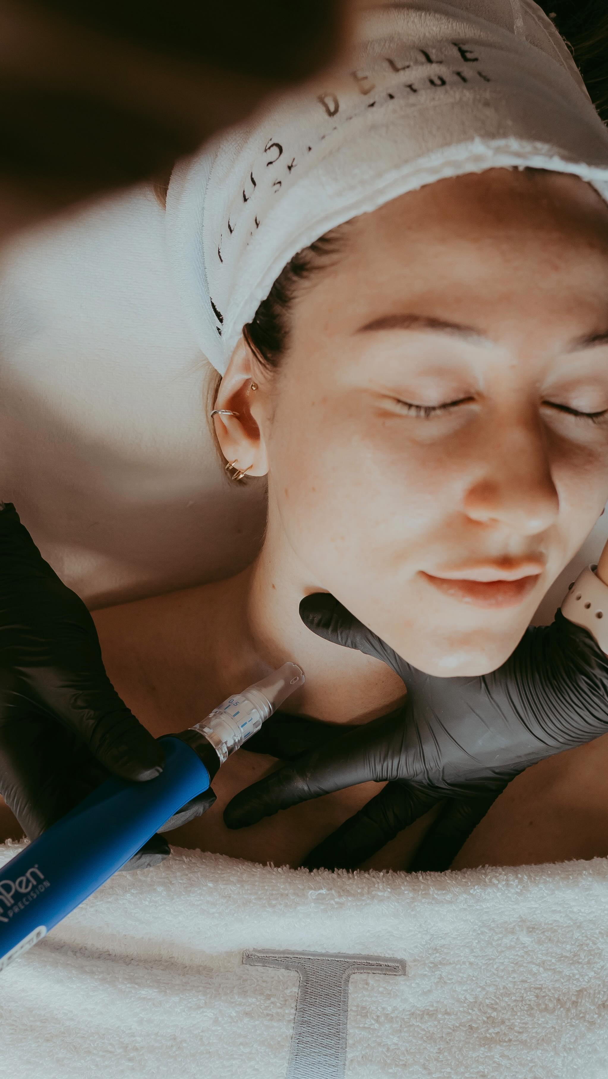 HET GEHEIM VOOR EEN STEVIGE, GLOWY HUID! 😍
__________
Collageen is het eiwit dat onze huid stevig, glad en jeugdig houdt. Het ondersteunt de elasticiteit, verzacht fijne lijntjes en zorgt voor een gezonde, stralende huidstructuur.
Vanaf je 25e vertraagt de collageenproductie van nature met ongeveer 1% per jaar. Wat na verloop van tijd kan leiden tot verslapping, fijne lijntjes en volumeverlies.
Onze SkinPen to the rescue dan! 😏
Met kleine, gecontroleerde microkanaaltjes stimuleren we de huid om nieuw collageen en elastine aan te maken, wat helpt om:
•fijne lijntjes en rimpels te verminderen
•de huidtextuur en egalisatie te verbeteren
•de huid op een natuurlijke manier te verstevigen en liften
•een stralende, jeugdige glow te ondersteunen
Door een sterke collageenbasis op te bouwen, blijft je huid jarenlang glad, vol en veerkrachtig.
‼️ Pro tip: Het is nooit te laat om te starten!
Nog vragen? Aarzel dan zeker niet om ons te contracteren!
Liefs,
Paulien.
__________
#medischemicroneedling #skinpen #microneedling #stevigehuid #glowyhuid @skinpen @skinpen_belgium