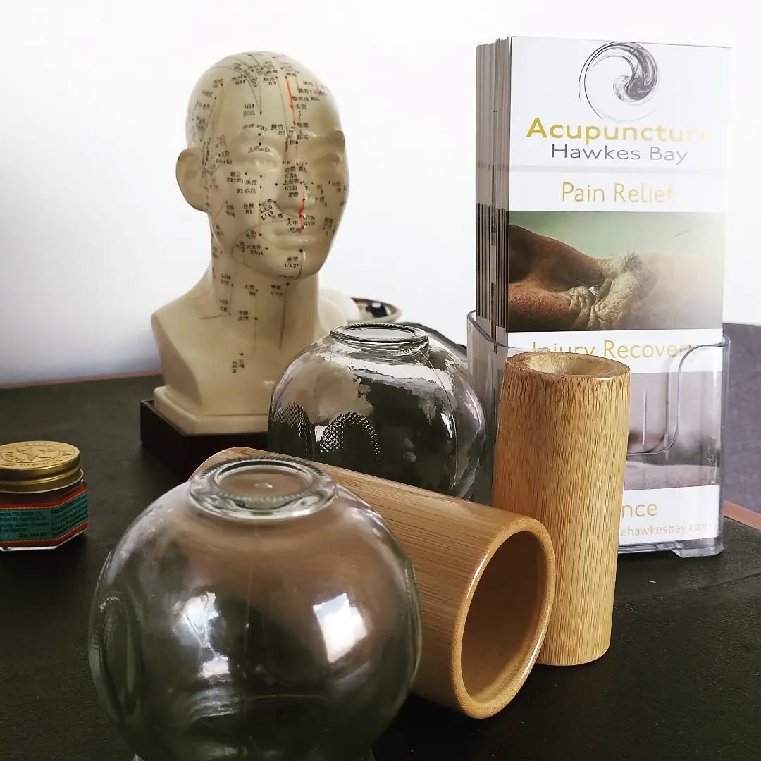 Did you know that cupping is one of the Chinese medicine modalities used in the acupuncture hawkes bay clinic here. www.acupuncturehawkesbay.com
#acupuncture #acupuncturehawkesbay