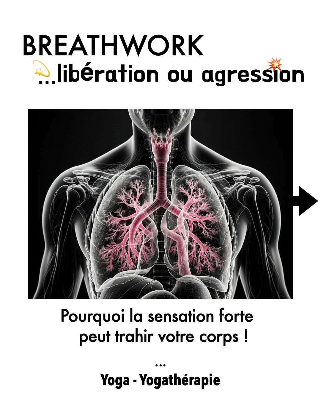 Breathwork : Pourquoi « respirer plus » peut vous asphyxier 🌬️⚠️
On nous promet souvent que l’intensité du souffle est synonyme de libération. Mais la science nous dit l’inverse :
La respiration n’est pas une question de volume, mais de justesse.
Regardez la courbe de dissociation de l’hémoglobine (Slide 4) : c’est la clé pour comprendre pourquoi l’hyperventilation est un piège.
❌ Le piège de l’Alcalose (Décalage à gauche) :
En forçant le souffle, vous évacuez trop de CO2. Résultat ? Votre hémoglobine devient « collante » et refuse de libérer l’oxygène. Vous respirez à pleins poumons, mais vos cellules (cerveau, muscles) s’asphyxient. C’est l’ivresse des profondeurs... à sec.
⚠️ Le revers de la médaille :
Pour compenser ce sang devenu trop alcalin, vos reins doivent travailler en urgence pour évacuer les bicarbonates. Vous imposez à vos organes tampons une gestion de crise permanente qui mène à l’épuisement profond.
✅ La voie de l’Aplomb (La zone bleue) :
La respiration juste est celle qui maintient l’homéostasie. Ni acidose, ni alcalose. C’est là que le placement du corps (l’Aplomb) intervient : il ne s’agit pas de forcer l’entrée de l’air, mais de libérer l’espace pour que l’oxygène atteigne réellement vos tissus.
Le vrai Pranayama est une science de l’équilibre, pas une performance de force.
✨ Envie d’aller plus loin ?
Nous avons détaillé la physiologie du souffle et les risques du Breathwork moderne dans notre dernier article de blog.
👇 Commentez « RESPIR » pour recevoir l’article complet et découvrir nos parcours de formation.
#Yogathérapie #Respiration #Breathwork #Anatomieyoga #Cathetsergeyoga