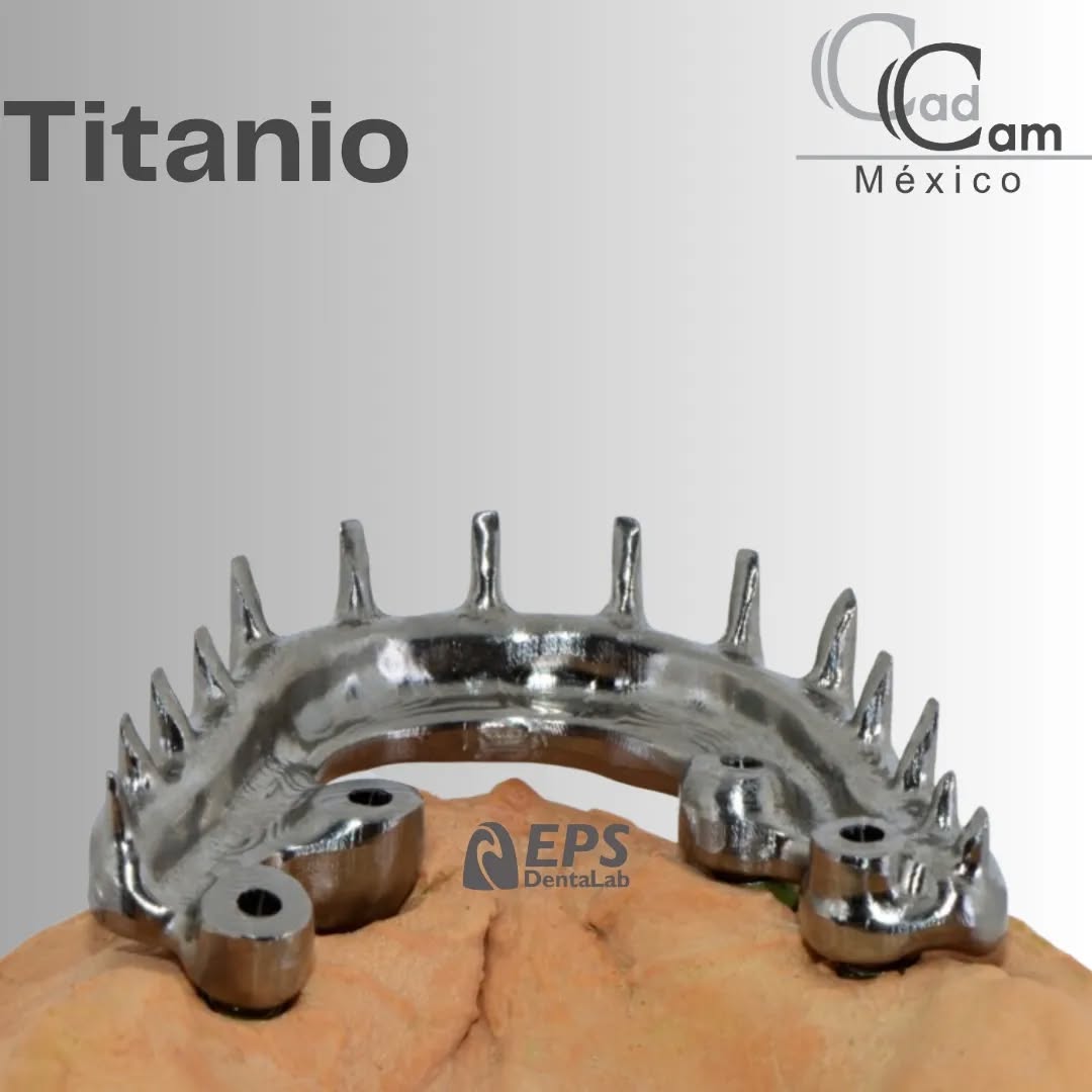 Infraestructura fresada en Titanio (Ti) para una rehabilitación de prótesis fija sobre 4 implantes de @labeps. La combinación de resistencia y precisión de CAD CAM México redefine los estándares.
-
-
-
- - -Aviso de responsabilidad: Todas las fotos publicadas en esta cuenta de Instagram son propiedad intelectual de Estudio de Porcelana Suizo S.A de C.V. y están protegidas por derechos de autor. #CadCam #Mexico #Cromocobalto #implantologia #implantesdentales #dentistry #dentista
