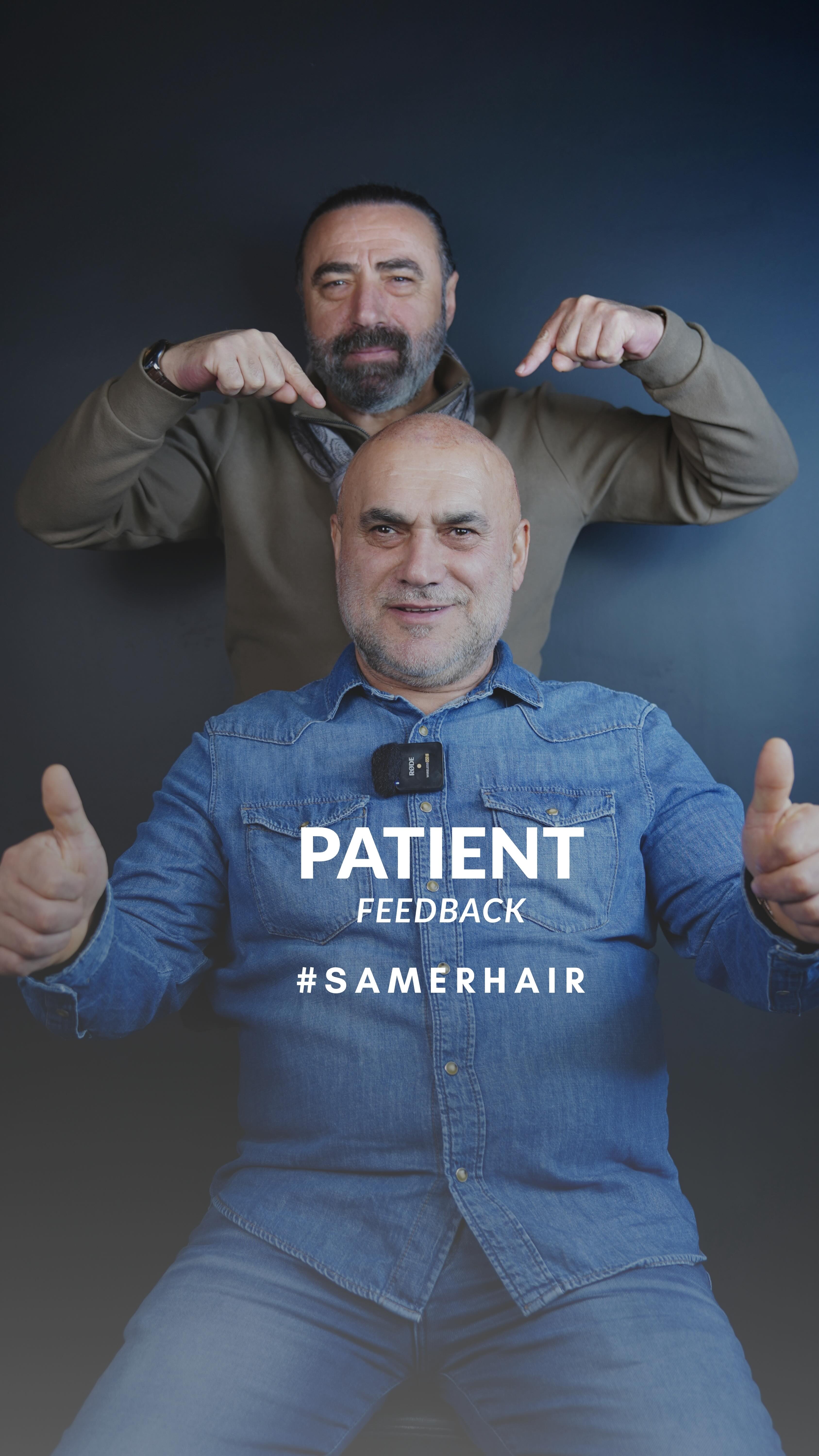 Yeni saçlar, yeni özgüven ✨
Doğal sonuçlar SamerHair’da başlar 💪
New hair, new confidence ✨
Natural results start with SamerHair 💪
Новые волосы — новая уверенность ✨
Естественные результаты с SamerHair 💪
-
-
-
-
-
#hairtransplant #hairtransplantturkey #saçekimi #istanbulhair #beforeafter