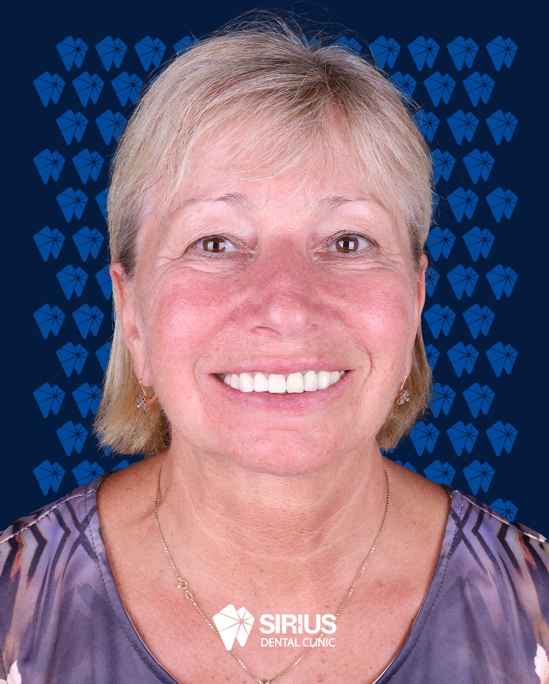 The upper front right area was renewed to precisely match the patient’s existing prostheses on the left side.
Form, shade, and occlusal balance were carefully planned to achieve a stronger, cleaner, and naturally harmonious smile.
The patient was discharged with confidence and satisfaction following a comfortable and well managed treatment process.