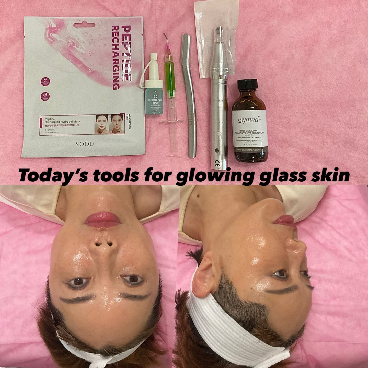 Treatment of the Day
Dermaplaning + Microneedling glow session
GlyMed TCA Pigment Lifting Peel ,Chlorophyll Brightening Ampoule
Dermaheal Skin Rejuvenation ampule.
http://www.Capricebeaytybar.com
#sarasota_florida #sarasotawomanowned #siestakeyvillage #sarasotamedspa #capricebeautybar
Peptide Recharging Collagen Mask