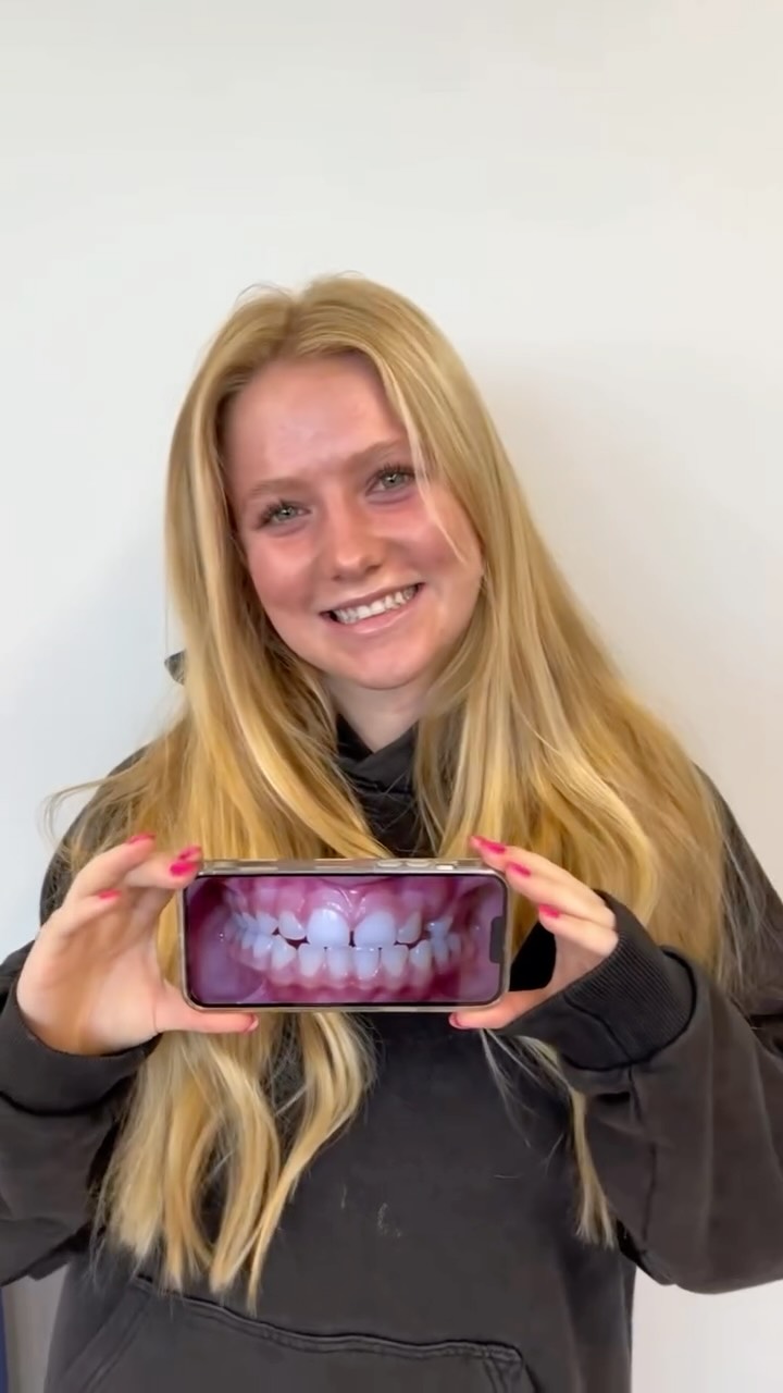 📣 Model Call‼️We are always filming real smile transformations and behind-the-scenes moments around the office! If being on camera sounds fun to you, let our team know, our camera is always ready!