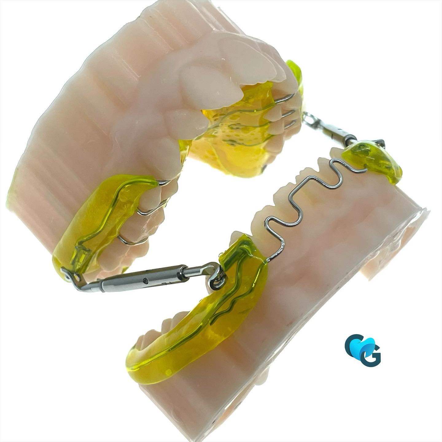 PUL 2 #pul #ortho #orthodontics #correction #classe1 #orthocolors #ortotooth #orthodontic #orthopassion #dent #dentaire #dental #dentalphotography