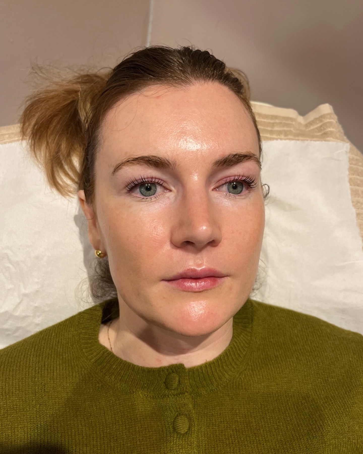 ✨ Glowy Micro-Needling and a Fresh Lash Lift.
High maintenance, so you don’t have to be 💁🏼♀️
#TheGlowBar #GlowBarLDN #SkinGlow #LashLift #Microneedling #GlassSkin