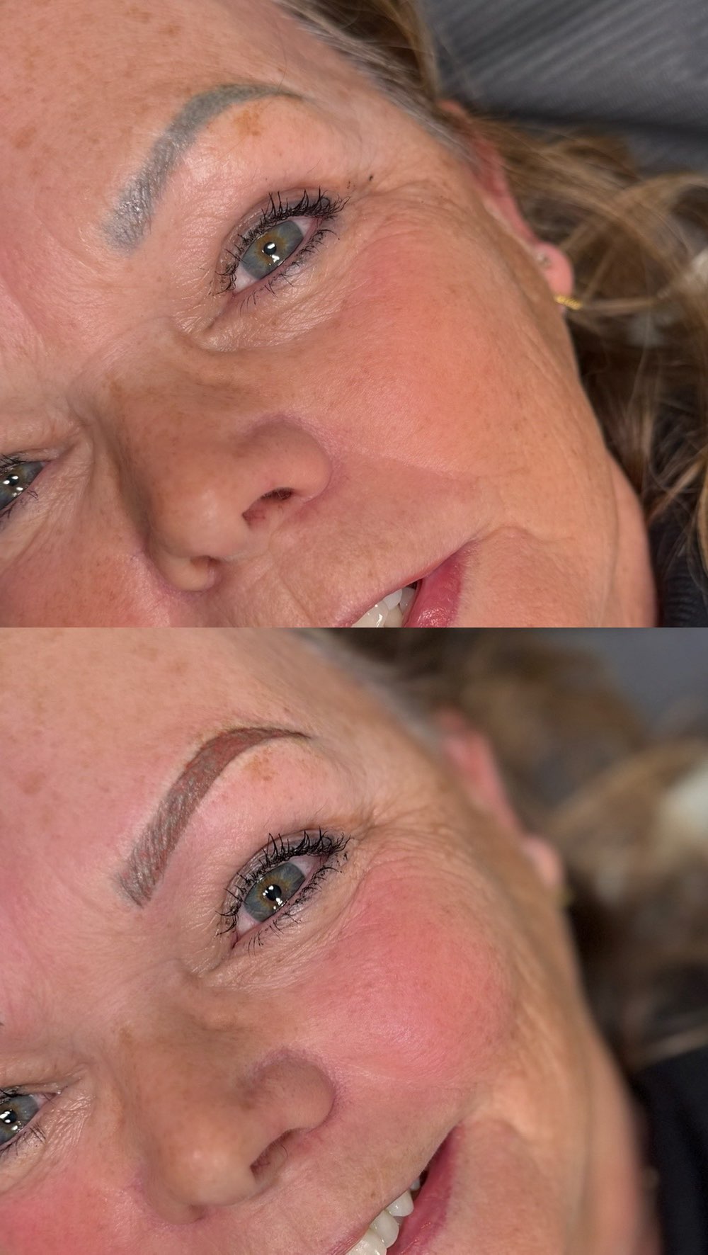 Have brow tattoo thats gone an undesirable Bluey/green tone? This is because there was no warmth added when they were first done, and the pigment was implanted deeper than required for semi permanent make up - making them very saturated.
In this situation, the best option is laser removal, but this can unfortunately be a long expensive process. I offer an alternative which is called colour correction (depending on the clients case), this is done by implanting a pigment colour that counter acts the correct hues to create a more pleasant shade. We currently include this service free of charge with our combination brows!
If you’re interested or have any questions, please get in touch!
#semipermanentmakeup #brows #pmubrows #spmu #eyebrows