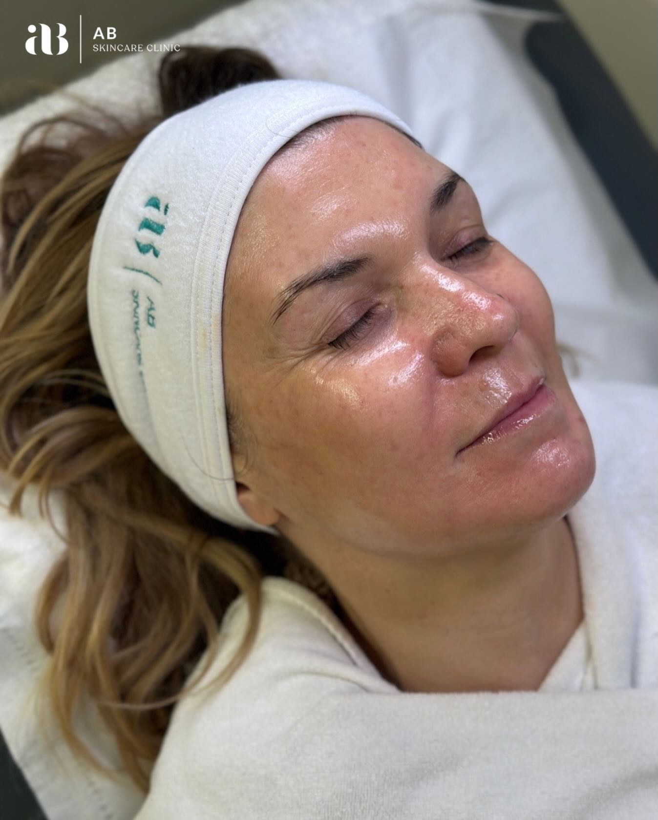 Not all chemical peels are created equal.
Image Skincare Peels stand out because they are ๐ฝ๐ฟ๐ผ๐ณ๐ฒ๐๐๐ถ๐ผ๐ป๐ฎ๐น๐น๐ ๐ณ๐ผ๐ฟ๐บ๐๐น๐ฎ๐๐ฒ๐ฑ to deliver real results safely, while nurturing your skinโs health.
๐ ๐๐๐๐๐๐๐ก-๐๐ง๐๐๐, ๐ฎ๐๐ฉ ๐๐๐ฃ๐ฉ๐ก๐ โ Designed for effectiveness without unnecessary irritation
๐ ๐พ๐ช๐จ๐ฉ๐ค๐ข๐๐ฏ๐๐ ๐จ๐ค๐ก๐ช๐ฉ๐๐ค๐ฃ๐จ โ Targeting pigmentation, acne, fine lines, and dullness
๐ ๐ผ๐๐ซ๐๐ฃ๐๐๐ ๐๐๐ฉ๐๐ซ๐ ๐๐ฃ๐๐ง๐๐๐๐๐ฃ๐ฉ๐จ โ Vitamin-rich, antioxidant-packed, and clinically tested
๐ ๐๐๐ฃ๐๐ข๐๐ก ๐๐ค๐ฌ๐ฃ๐ฉ๐๐ข๐ โ Reveal smoother, brighter skin without disrupting your lifestyle
Experience the science of skincare combined with the luxury of visible transformation. A superior approach to your skins rejuvenation.
๐
Book your peel treatments today and see the difference yourself.
AB Skincare Clinic
๐Talbot Green
๐งapril@abskincareclinic.co.uk
๐ฒ07763047220