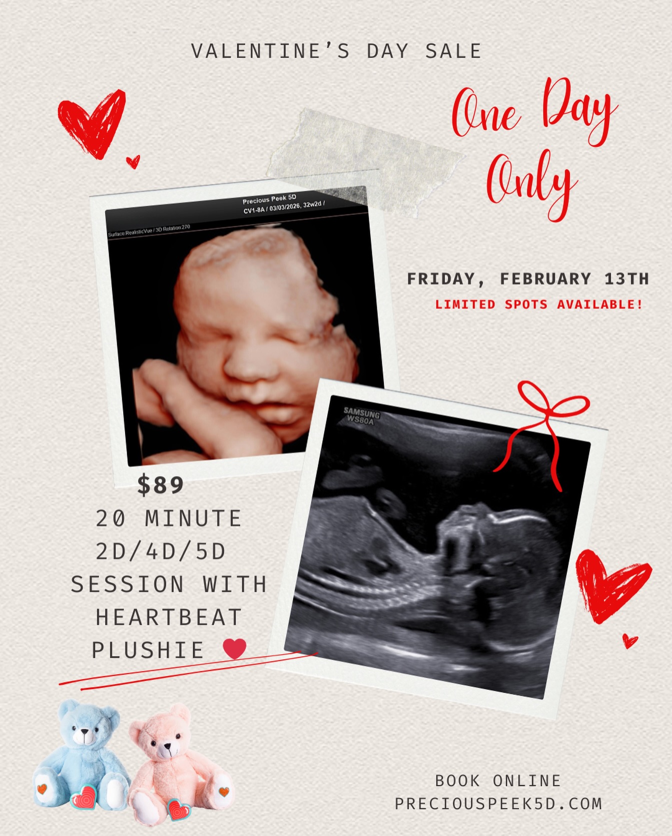 Sweetheart Peek ❤️
💕 20-minute 2D / 4D / 5D ultrasound
💕 8” Heartbeat Plush
💕 Digital images + 4 prints
❤️ February 13th only
❤️ 12+ weeks | Limited spots
Book online at preciouspeek5D.com before it’s gone 💝