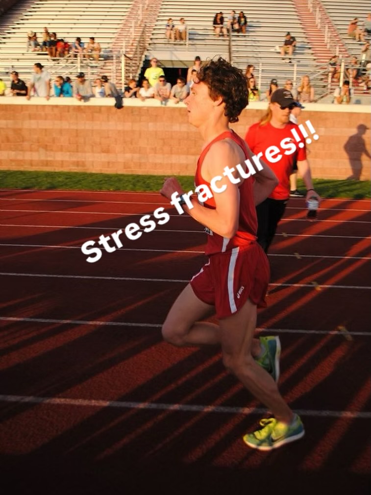 Stress fractures are an unfortunate reality for a lot of runners. They are a perfect example of why the little bits of recovery are important. Making sure you are properly fueling and sleeping are going to go a long way. Additionally, quickly identifying these bone stress injuries from joint pain are key to prompt diagnosis and catching these early. Check out the blog post for more about my experiences.
https://www.fullstridespinesport.com/post/my-history-with-stress-fractures
#chiro #williamsburgbrooklyn #runninginjuryfree #health #chiropratic
Running injuries in Williamsburg, Brooklyn